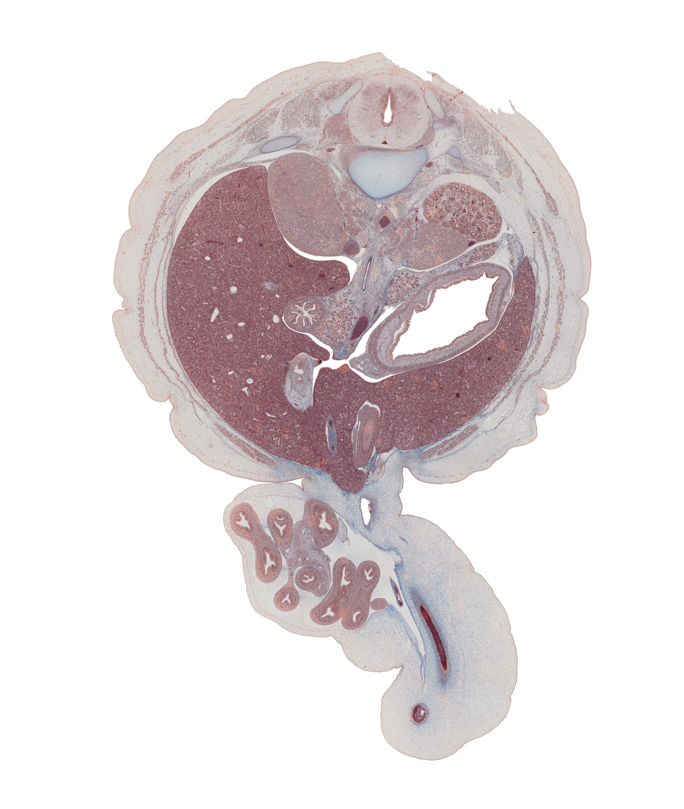 T-12 spinal ganglion, anterior spinal artery, aorta, body of dorsal pancreas, descending part of duodenum, edge of umbilical vein, gall bladder, greater curvature of stomach, head of ventral pancreas, herniated intestines, inferior vena cava, kidney (metanephros), left lobe of liver, left umbilical artery, lesser sac (omental bursa), peritoneal cavity, quadrate lobe of liver, rib 12, superior mesenteric artery, superior mesenteric vein, suprarenal gland, suprarenal gland cortex, sympathetic trunk, umbilical coelom, umbilical cord, umbilical vein, umbilical vesicle stalk