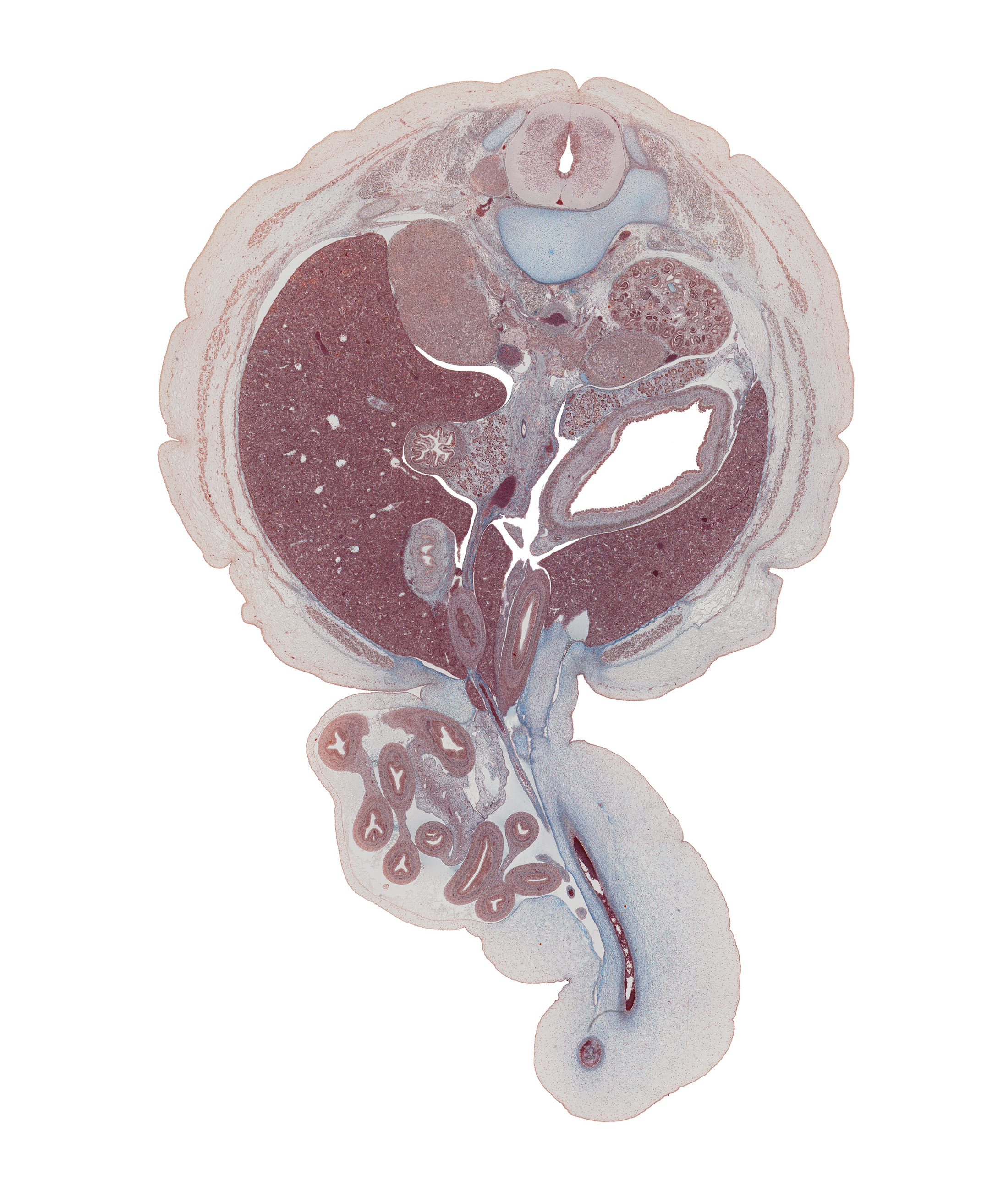 T-11 / T-12 interganglion region, body of dorsal pancreas, caudal edge of pleural recess, cephalic edge of jejunum, colon, descending part of duodenum, diaphragm, gall bladder, head of ventral pancreas, ileum, inferior vena cava, kidney (metanephros), left umbilical artery, lesser sac (omental bursa), mesentery, notochord, origin of left renal artery, origin of right renal artery, stomach, superior mesenteric artery, superior mesenteric vein, superior mesenteric vessels, suprarenal gland cortex, tail of dorsal pancreas, umbilical coelom, umbilical cord, umbilical vein, umbilical vesicle stalk