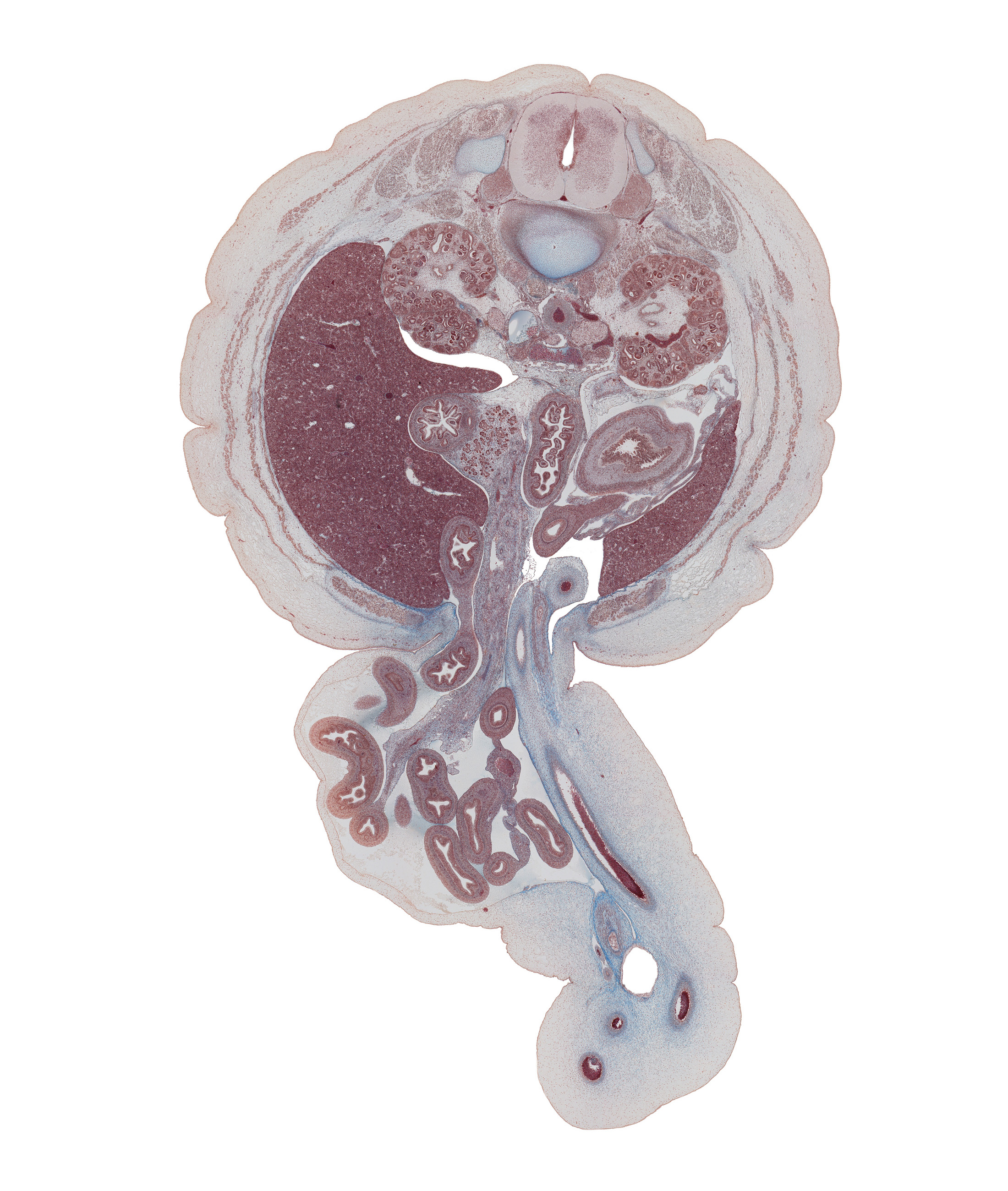 L-1 spinal ganglion, allantoic vesicle(s), aorta, aorticorenal ganglion, caudal edge of body of dorsal pancreas, colon, descending part of duodenum, duodenal papilla, extension of umbilical coelom, herniated intestines, ileum, inferior vena cava, junction of duodenum and jejunum, latissimus dorsi muscle, left lobe of liver, left umbilical artery, mesentery, mesocolon, minor calyx, posterior layer of thoracolumbar fascia, right lobe of liver, right umbilical artery, stomach, superior major calyx, umbilical vein, umbilical vesicle stalk, uncinate process of ventral pancreas, urachus