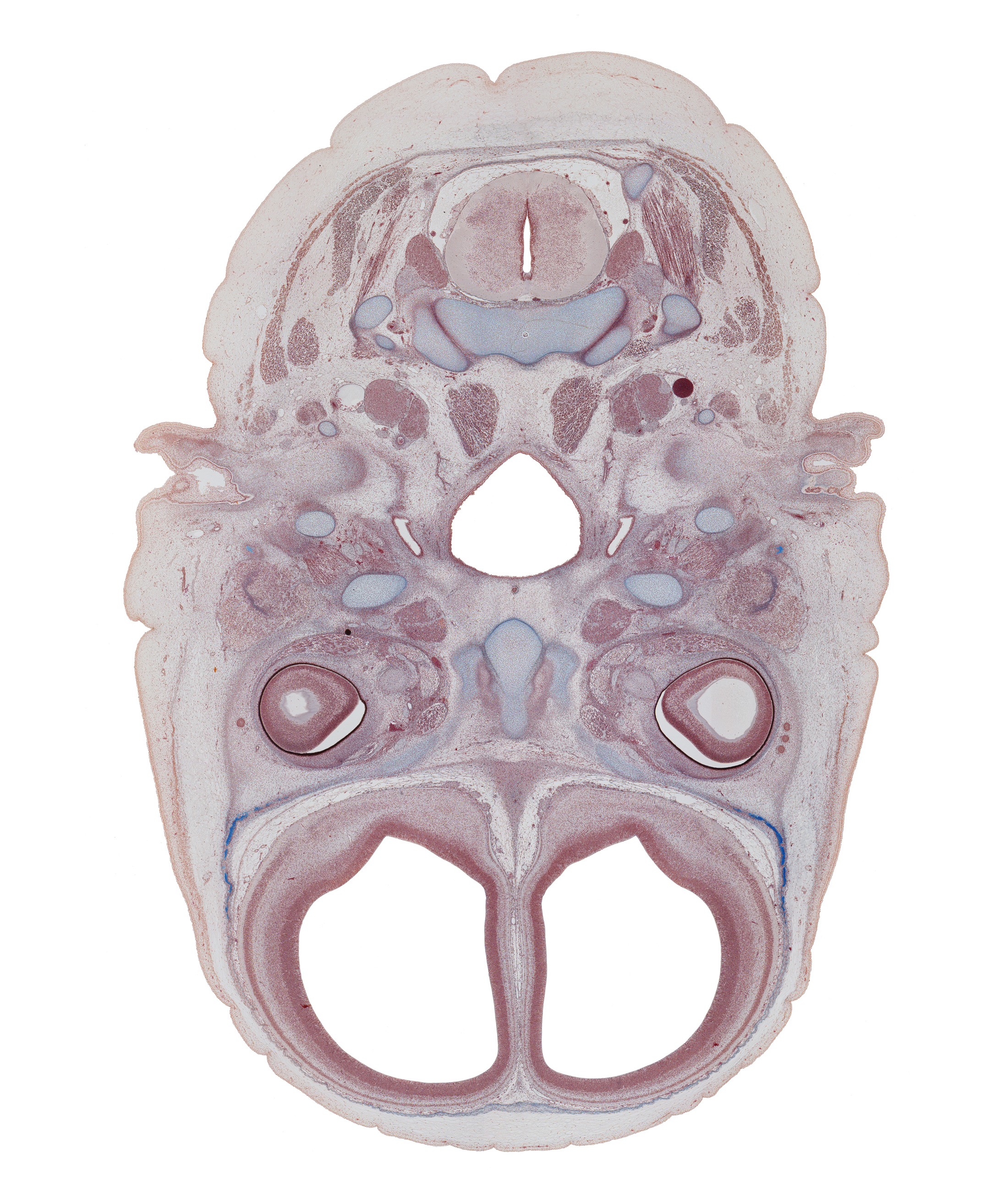 C-2 spinal ganglion, auricle, edge of nasal cavity (nasal sac), falx cerebri region, frontal bone, inferior ganglion of vagus nerve (CN X), intraretinal space (optic vesicle cavity), lateral rectus muscle, lateral ventricle, longus capitis muscle, medial pterygoid muscle, nasopharynx, obliquus capitis inferior muscle, optic cup cavity, optic nerve (CN II), pharyngotympanic tube, pterygoid, pterygopalatine ganglion, semispinalis capitis muscle, semispinalis cervicis muscle, splenius muscle, superior cervical sympathetic ganglion, trapezius muscle