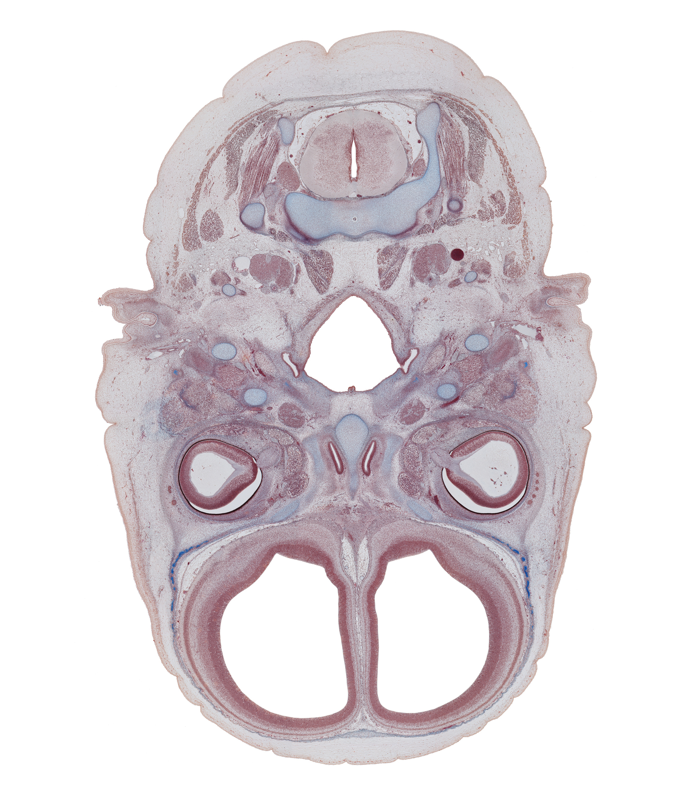 C-2 spinal ganglion, centrum of C-2 vertebra (axis), cortical plate, ethmoid, internal jugular vein, intervertebral foramen, intraretinal space (optic vesicle cavity), lacrimal gland buds, lateral ventricular eminence (telencephalon), medial pterygoid muscle, nasopharynx, neural layer of retina, opening of pharyngotympanic tube, optic nerve (CN II), pharyngeal arch 1 cartilage (Meckel), pigmented layer of retina, posterior belly of digastric and stylohyoid muscles, pterygopalatine ganglion, styloid process, superior pharyngeal constrictor muscle