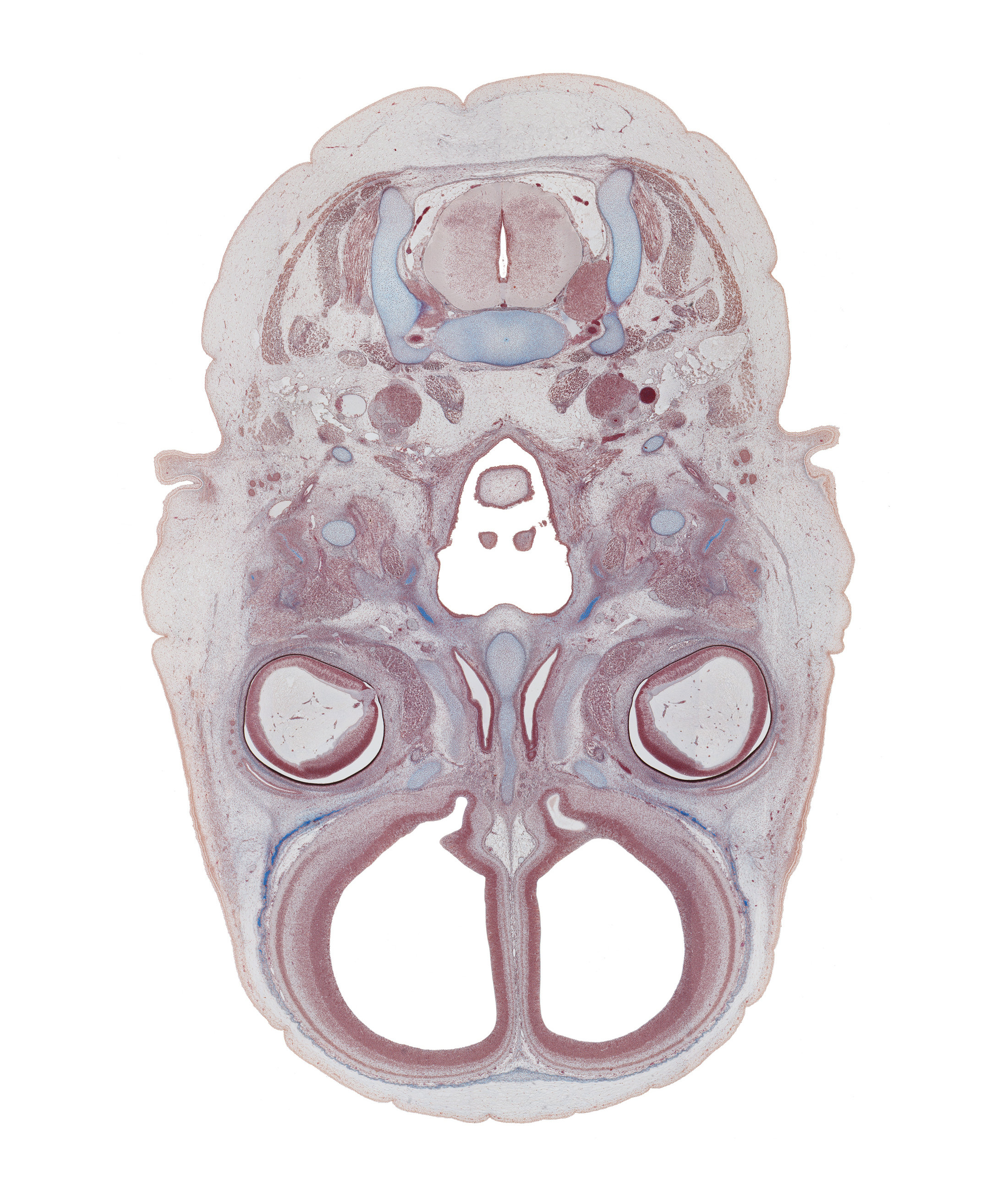 C-3 spinal ganglion, caudal part of auricle, crista galli, edge of epiglottis, edge of unfused palatine shelf, ethmoid, falx cerebri region, frontal bone ossification, internal carotid artery, laryngeal pharynx, lateral ventricle, nasal cavity (nasal sac), nasopharynx, notochord, olfactory bulb, olfactory ventricle, oropharynx, styloid process, superior pharyngeal constrictor muscle, superior sagittal sinus