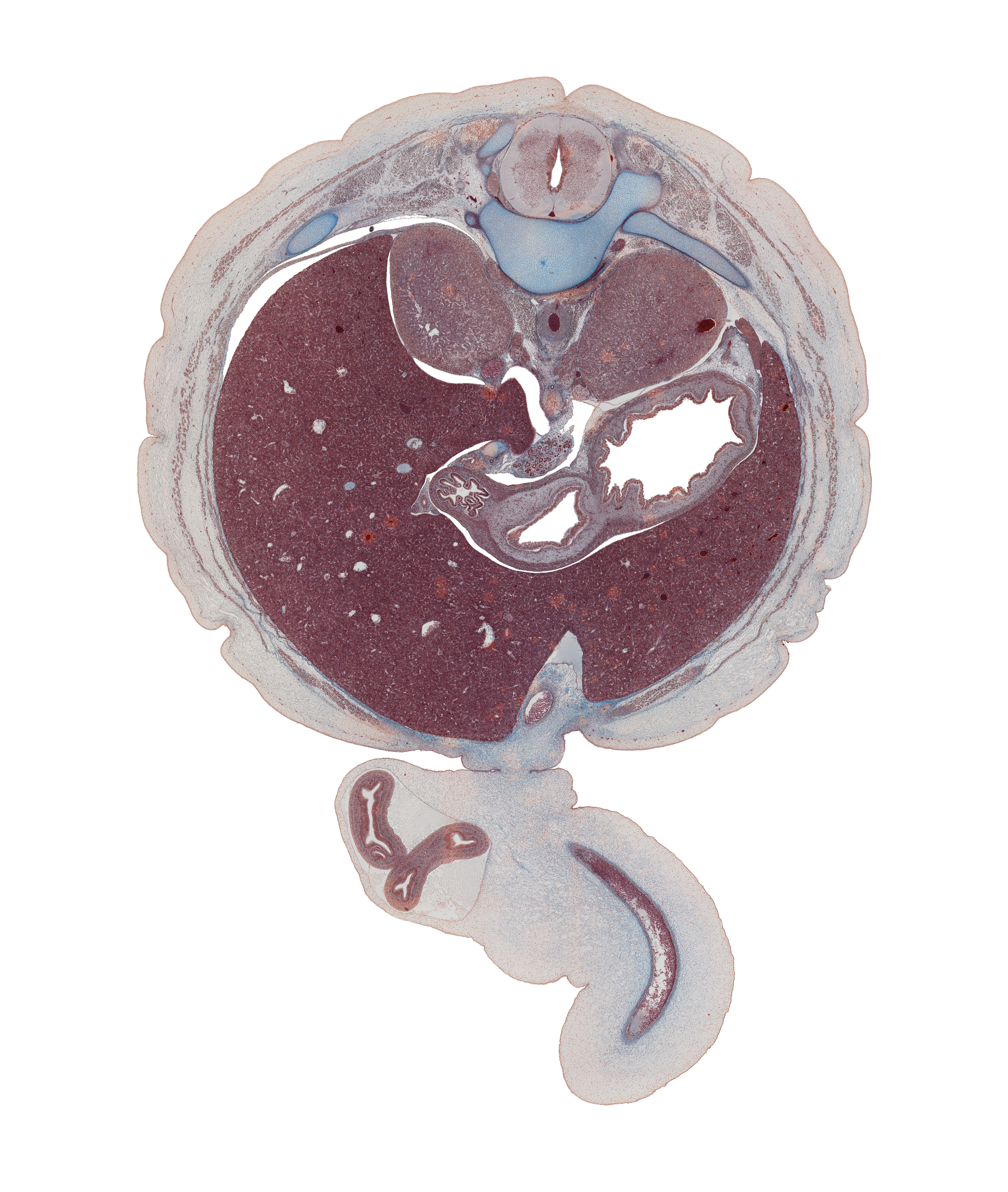 T-11 / T-12 interganglion region, aorta, body of stomach, dorsal mesoduodenum, falciform ligament, greater sac, head of ventral pancreas, hepatic and cystic ducts, hepatic portal vein, herniated intestines, inferior vena cava, left crus of diaphragm, left lobe of liver, notochord, pyloric antrum of stomach, rib 12, right crus of diaphragm, right lobe of liver, spleen, suprarenal gland, sympathetic trunk, umbilical coelom, umbilical cord, umbilical vein