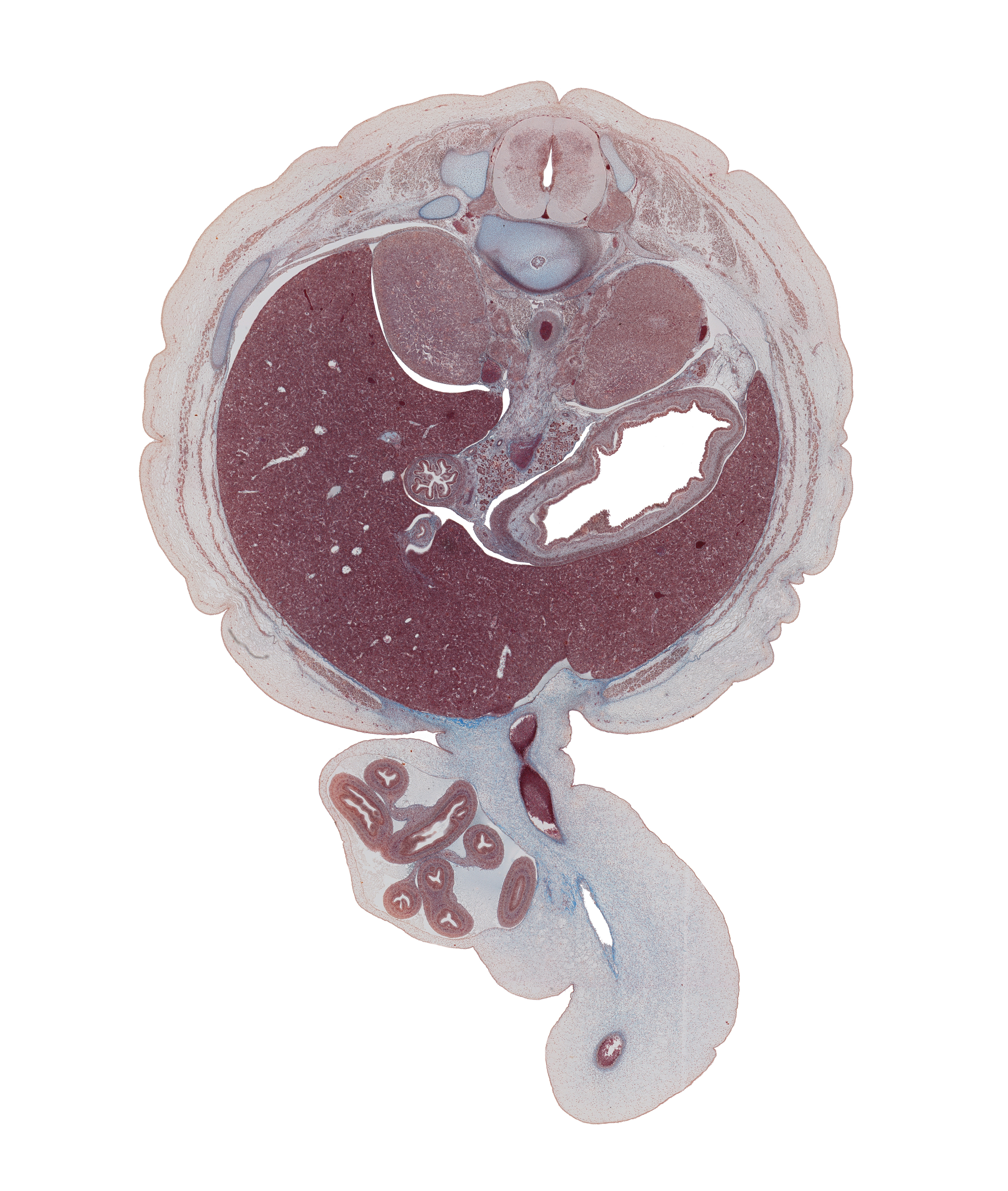 T-12 spinal ganglion, T-12 spinal nerve, anterior rectus sheath, aorta, cystic duct, descending part of duodenum, dorsal mesogastrium, extension of umbilical coelom, external abdominal oblique muscle, greater sac, inferior vena cava, internal abdominal oblique muscle, latissimus dorsi muscle, least splanchnic nerve, lesser sac (omental bursa), notochord remnant (nucleus pulposus), posterior wall of stomach, subcostal nerve, superior mesenteric vein, suprarenal gland, sympathetic trunk, transversus abdominis muscle, umbilical coelom, umbilical cord, umbilical vein