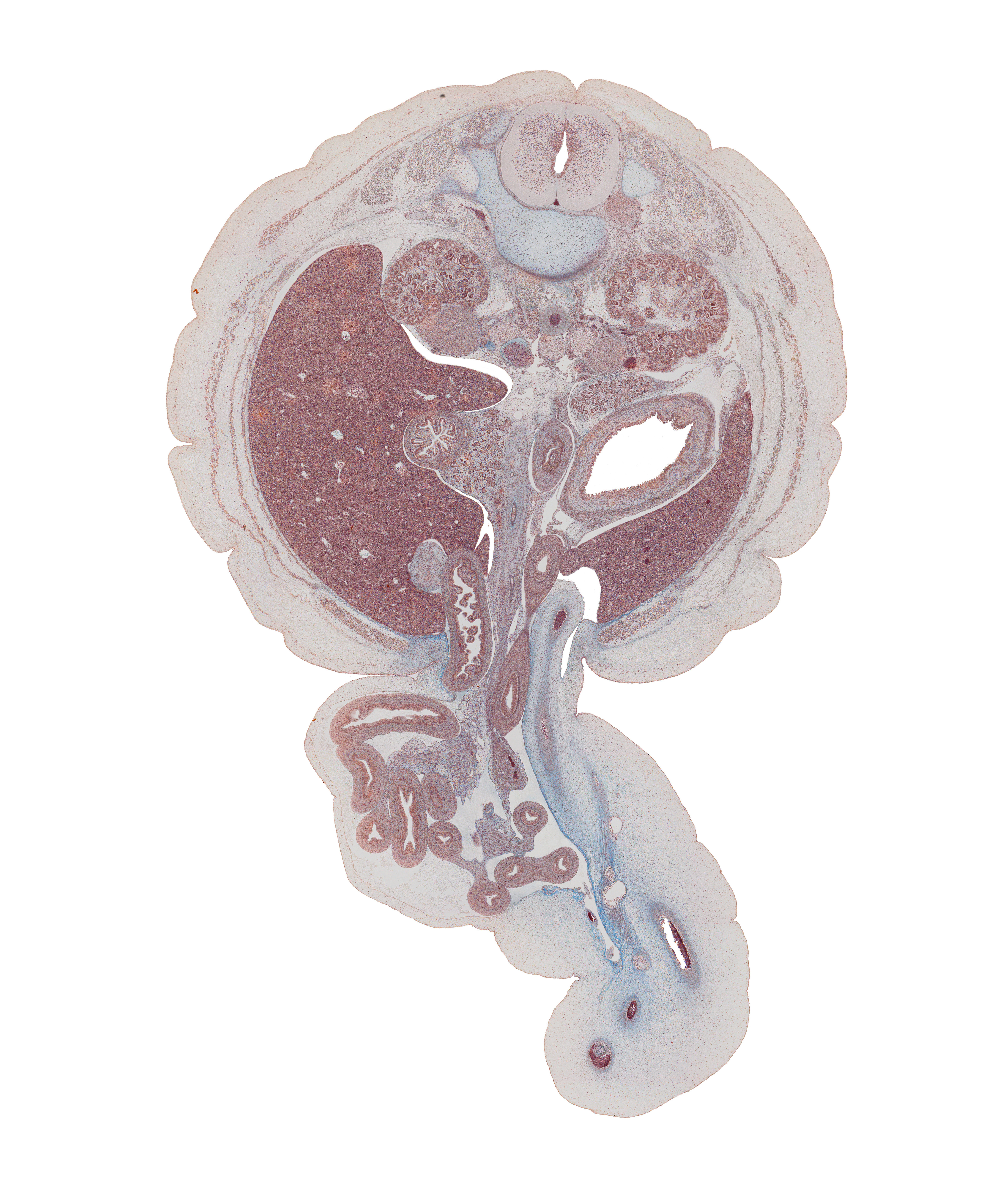 L-1 spinal ganglion, allantoic vesicle(s), anterior wall of stomach, aorta, ascending part of duodenum, colon, descending part of duodenum, edge of urachus, extension of umbilical coelom, gall bladder, head of ventral pancreas, herniated intestines, hilum of kidney (metanephros), inferior vena cava, jejunum, kidney (metanephros), left umbilical artery, lesser sac (omental bursa), mesocolon, right umbilical artery, superior mesenteric artery, superior pancreaticoduodenal artery, suprarenal gland cortex, suprarenal gland medulla, umbilical cord, umbilical vein, umbilical vesicle stalk