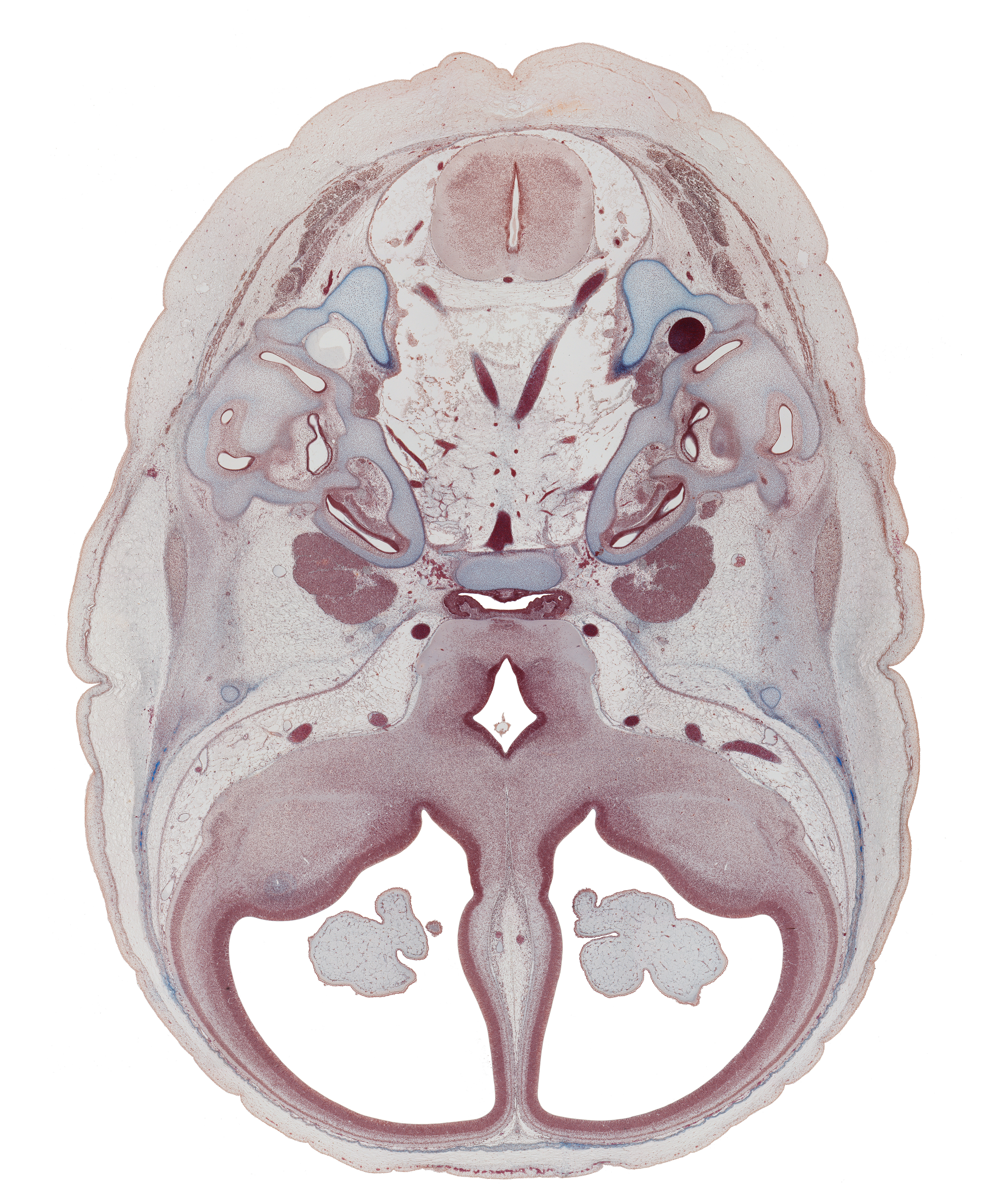 abducens nerve (CN VI), adenohypophysis (intermediate part), anterior spinal artery, basilar artery, basisphenoid, caudal part of medulla oblongata, cochlear duct, foramen magnum, hypothalamus, junction of cochlear duct and saccule, junction of internal jugular vein and sigmoid sinus, labrynthine artery, lateral semicircular duct, lateral ventricle, middle cerebral artery, neurohypophysis, optic groove, optic tract, piriform cortex (paleopallium), posterior semicircular duct, superior ganglion of glossopharyngeal nerve (CN IX), superior ganglion of vagus nerve (CN X), third ventricle, vertebral artery