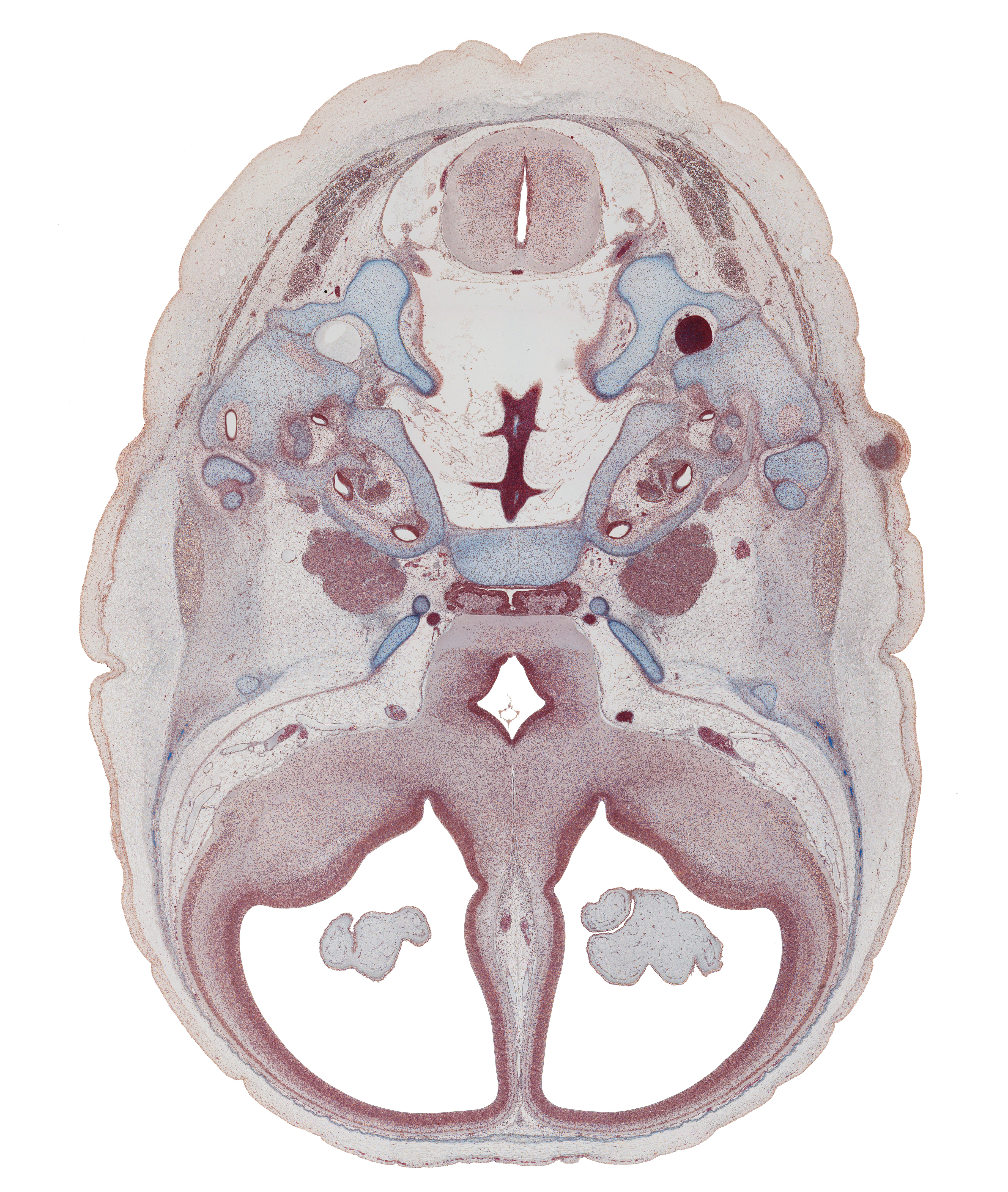 anterior spinal artery, basilar artery, basisphenoid, central canal, cochlear duct, distal part of adenohypophysis, facial nerve (CN VII), foramen magnum, frontal bone ossification, geniculate ganglion (CN VII), hippocampus, internal carotid artery, jugular foramen, junction of brain and spinal cord, junction of vertebral arteries, lateral semicircular duct, lateral ventricular eminence (telencephalon), lesser wing of sphenoid, medial ventricular eminence (diencephalon), middle cerebral artery, nucleus accumbens, optic groove, residual lumen, semispinalis capitis muscle, splenius muscle, stapes, subarachnoid space, sulcus terminalis, vertebral artery