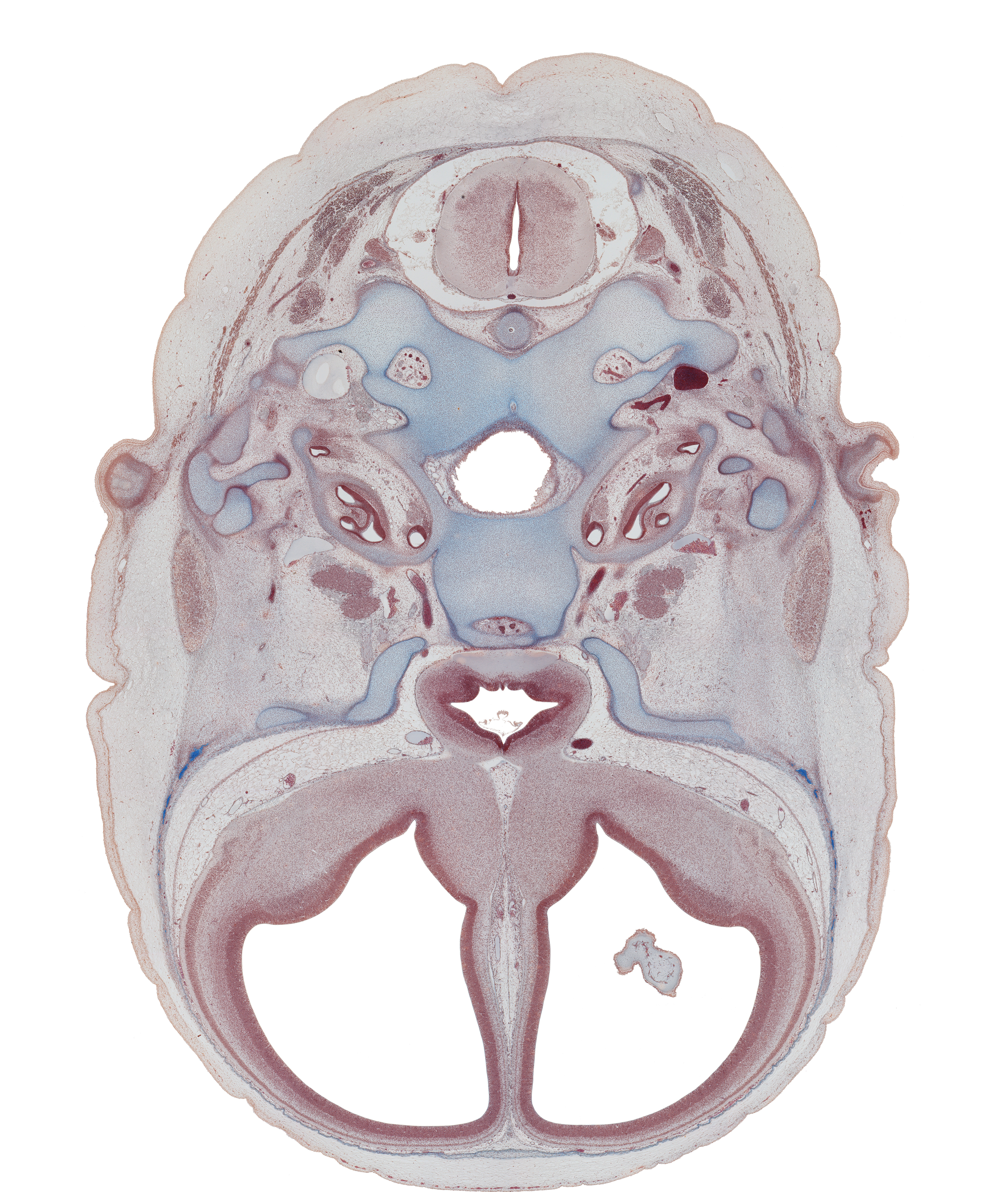 C-1 spinal ganglion, anterior spinal artery, basi-occipital (basal plate), central canal, cochlear duct, cranial cavity, edge of choroid plexus, hypoglossal canal, hypophysial fossa, incus, intermediate zone, internal carotid artery, internal jugular vein, lamina terminalis, lesser wing of sphenoid, malleus, mandibular nerve (CN V₃), marginal zone, nucleus accumbens, ophthalmic nerve (CN V₁), optic chiasma (chiasmatic plate), optic groove, piriform cortex (paleopallium), styloid process, temporalis muscle, tuberculum sellae, ventricular zone