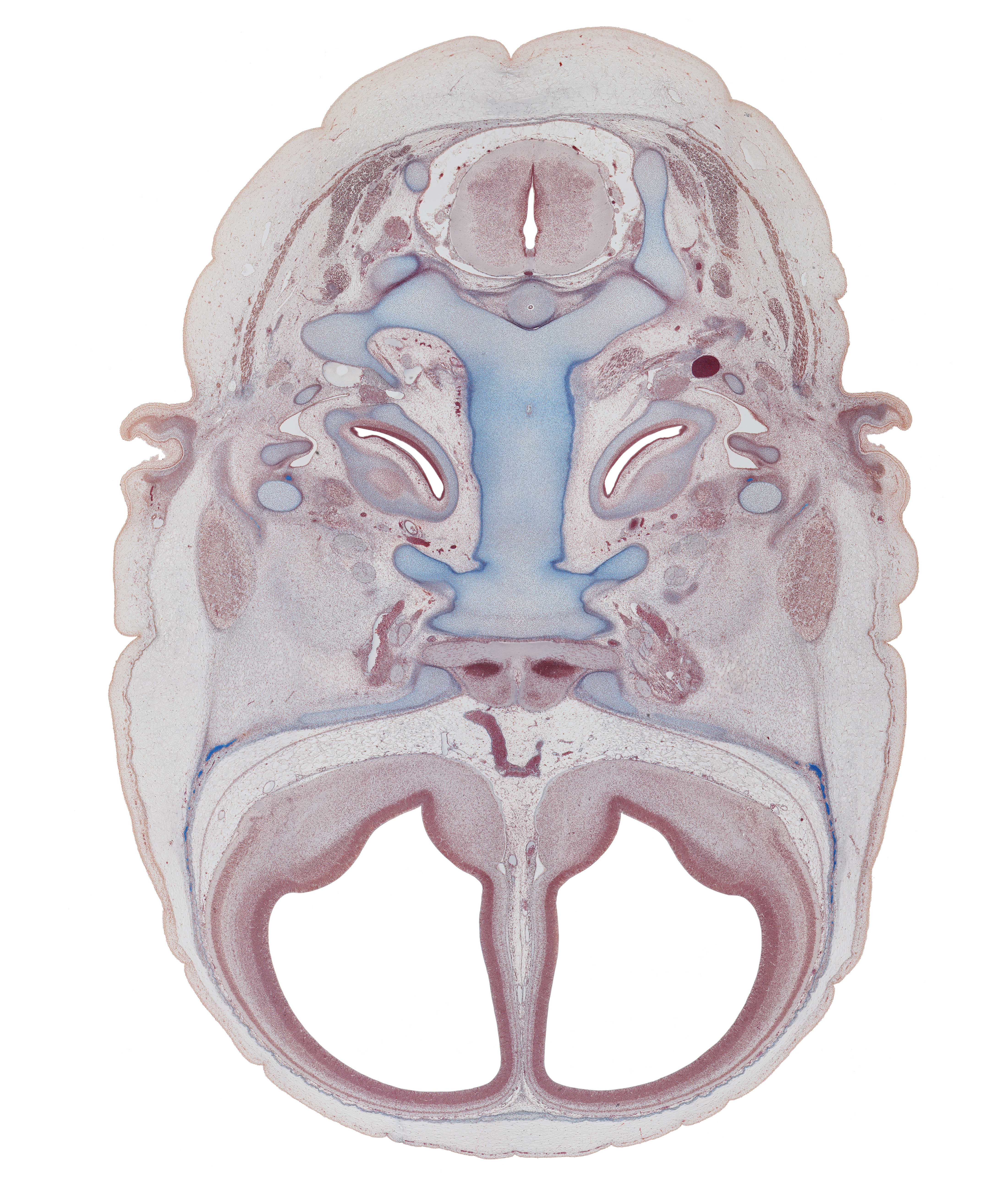 anterior communicating artery, atlanto-occipital joint, auricle, basi-occipital (basal plate), carotid canal, caudal part of cochlear duct, central canal, chorda tympani nerve, dens of C-2 vertebra (axis), greater wing of sphenoid, incus, internal carotid artery, malleus, mandibular nerve (CN V₃), maxillary nerve (CN V₂), neural arch of C-1 vertebra (atlas), notochord remnant, occipital condyle, ophthalmic nerve (CN V₁), optic canal, optic nerve (CN II), otic capsule, pre-optic area, spinal accessory nerve (CN XI), spinal cord, superior orbital fissure