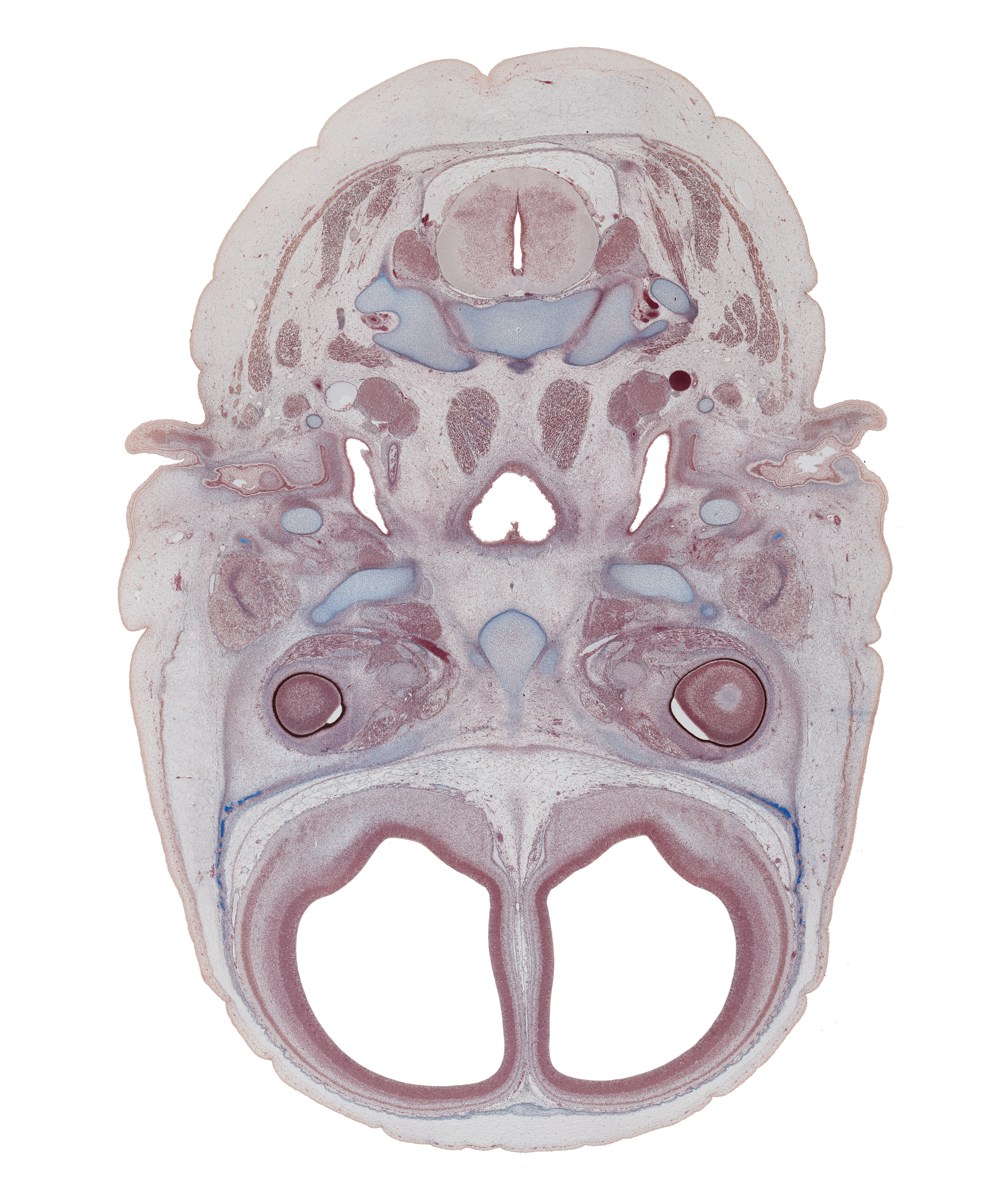 C-2 spinal ganglion, atlanto-axial joint, auricle, central canal, dural limiting membrane, edge of intraretinal space (optic vesicle cavity), edge of nasopharynx, ethmoid, external acoustic meatus, falx cerebri region, frontal bone ossification, internal carotid artery, jugular lymph sac, lateral rectus muscle, lateral ventricular eminence (telencephalon), middle ear (tympanic) cavity, posterior belly of digastric muscle, semispinalis capitis muscle, sphenoid, stylohyoid part of pharyngeal arch 2 cartilage, subarachnoid space, superior cervical sympathetic ganglion