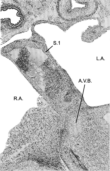The primary interatrial septum (septum primum) and the atrioventricular bundle