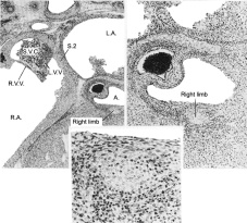 The right limb of the atrioventricular bundle