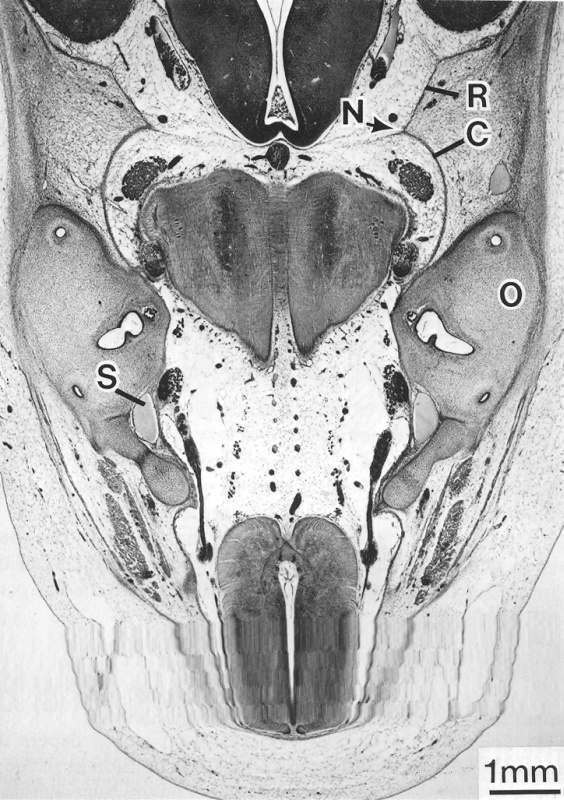 Dural limiting layer, pachymeninx, and skeleton