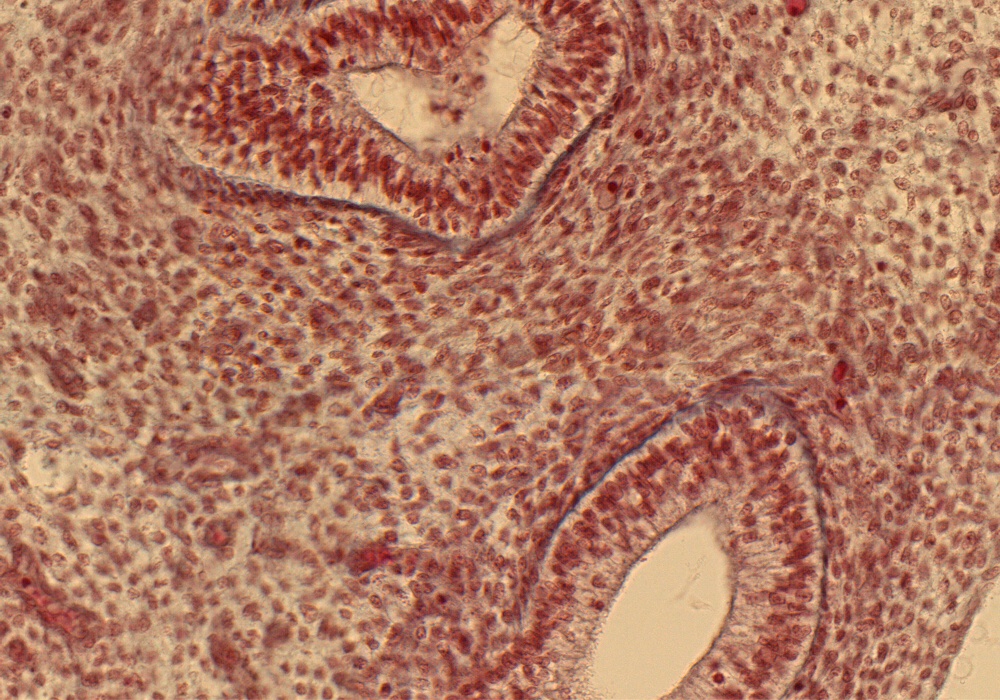 Bronchus Rt. Lung