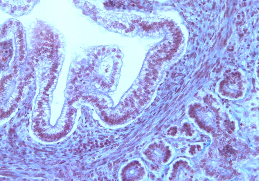 Duodenum Wall and Pancreas Head