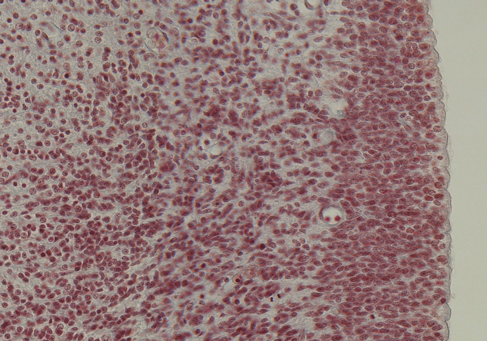 Ventricular Zone of Third Ventricle