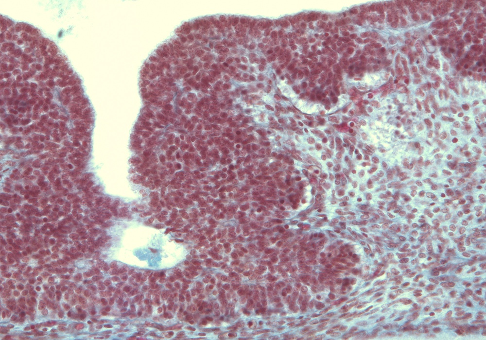 Adenohypophysis Medial Part