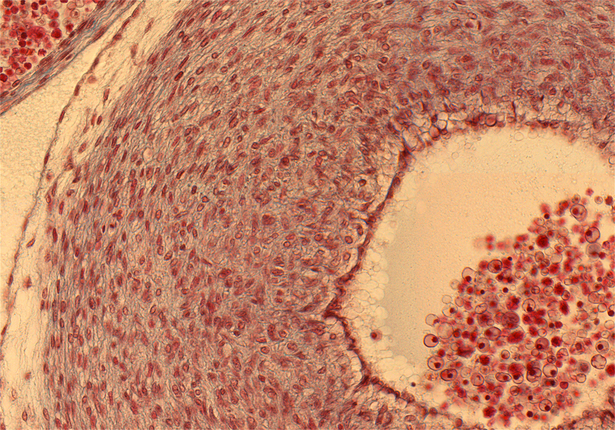 Ascending Aorta Wall