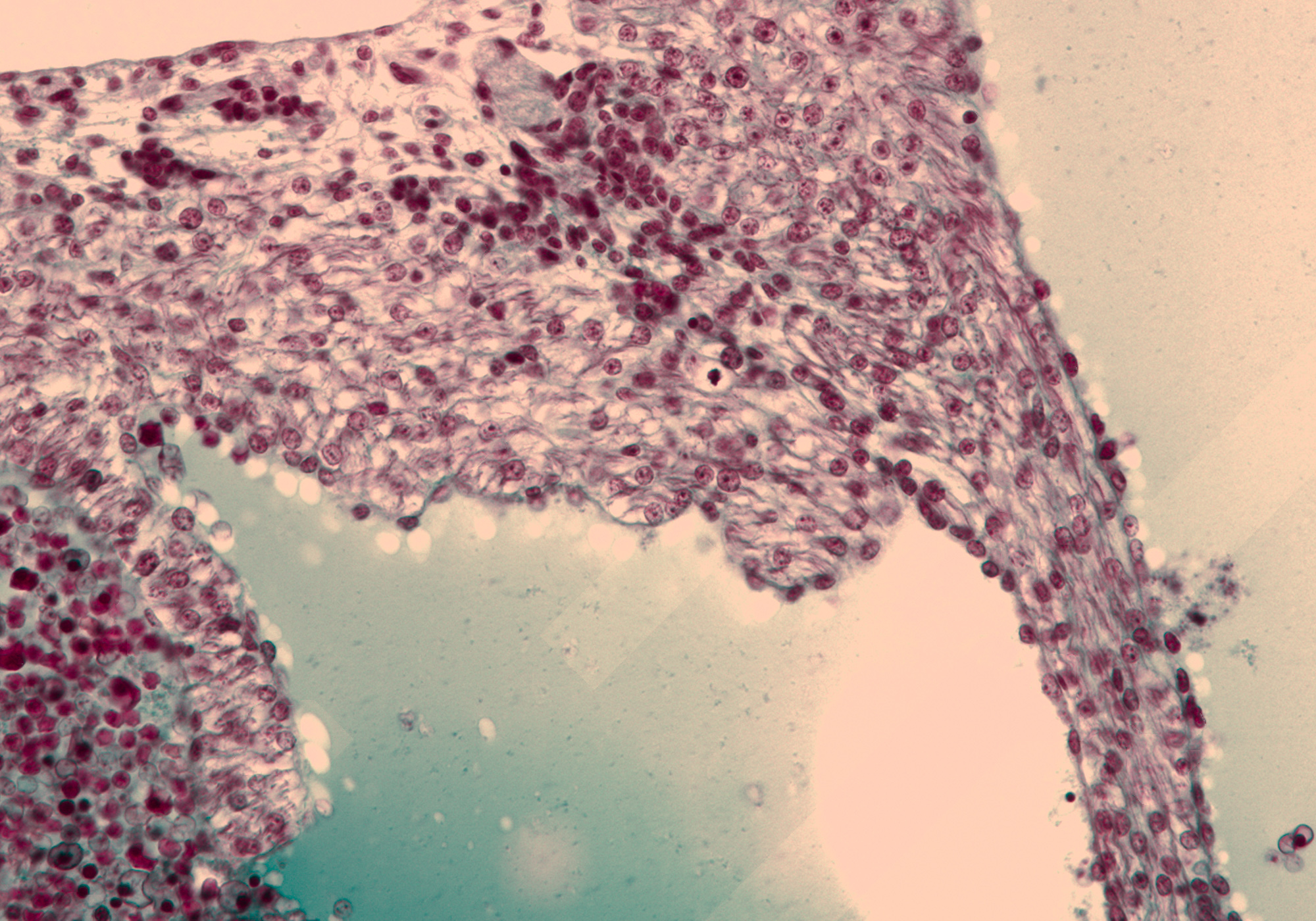 Interatrial Septum