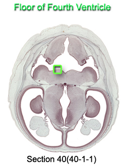 Floor of Fourth Ventricle