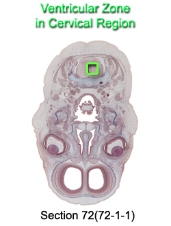 Ventricular Zone in Cervical Region