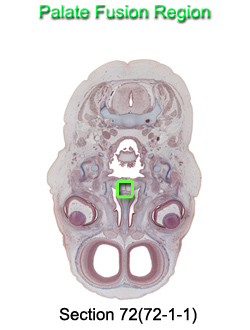 Palate Fusion Region