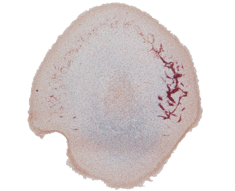 Osteogenic Layer at Top of Head