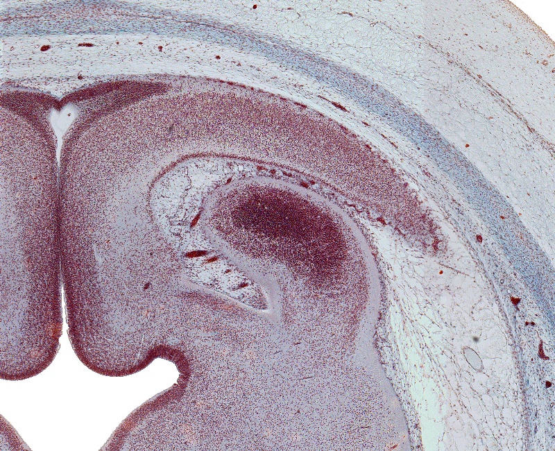 Isthmus of Rhombencephalon, Caudal Inferior Colliculus, and CN IV Rootlets