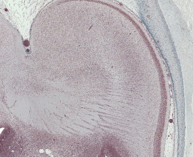 Globus Pallidus, Putamen, and Claustrum