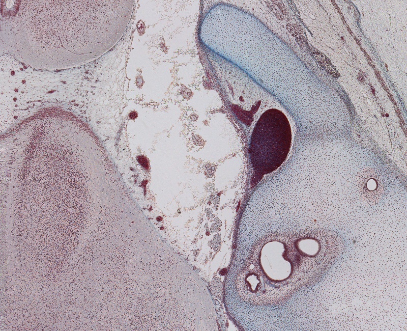 Rootlets of Hypoglossal Nerve