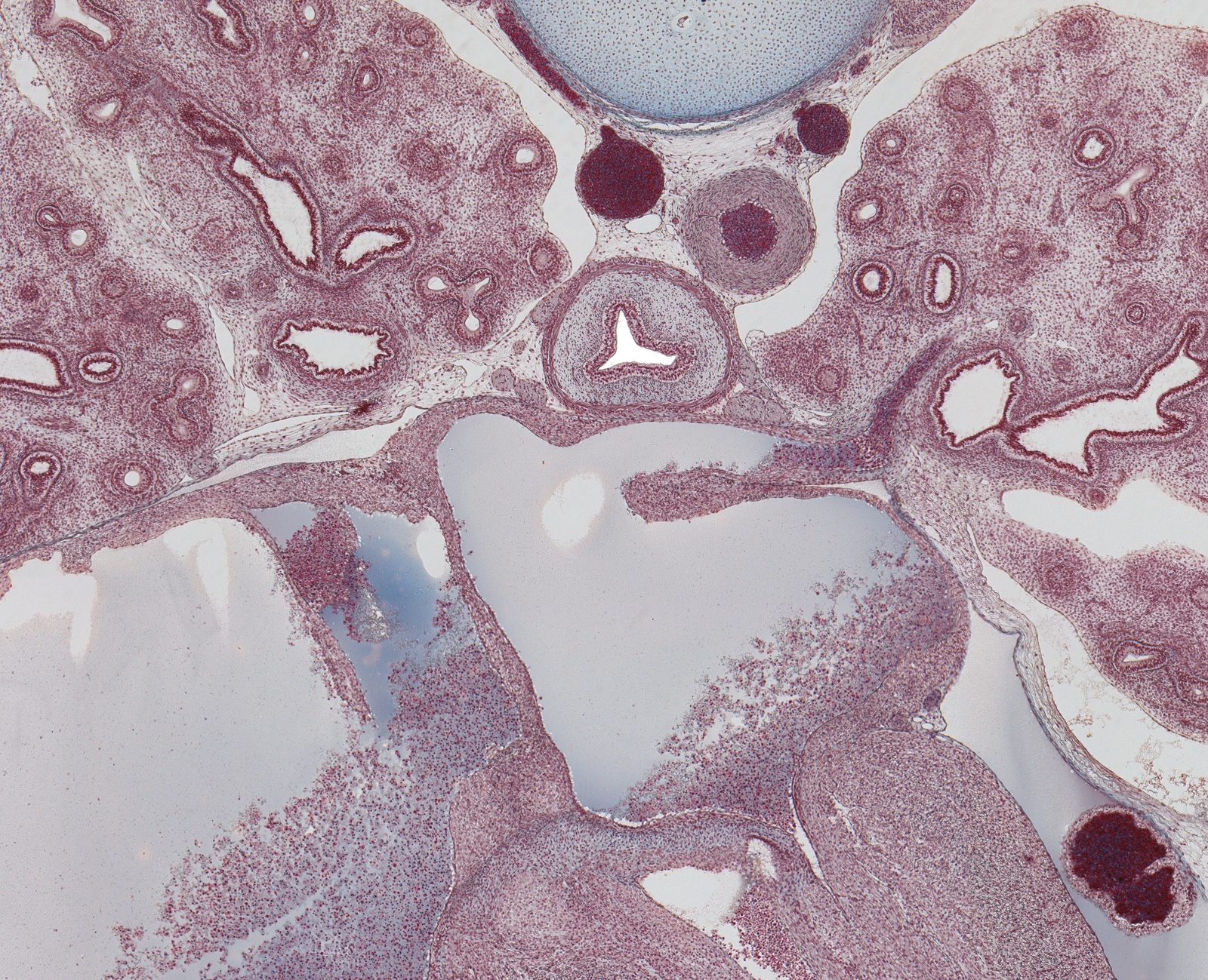 Heart, Lt. Atrium, Pul. VV. and Lungs