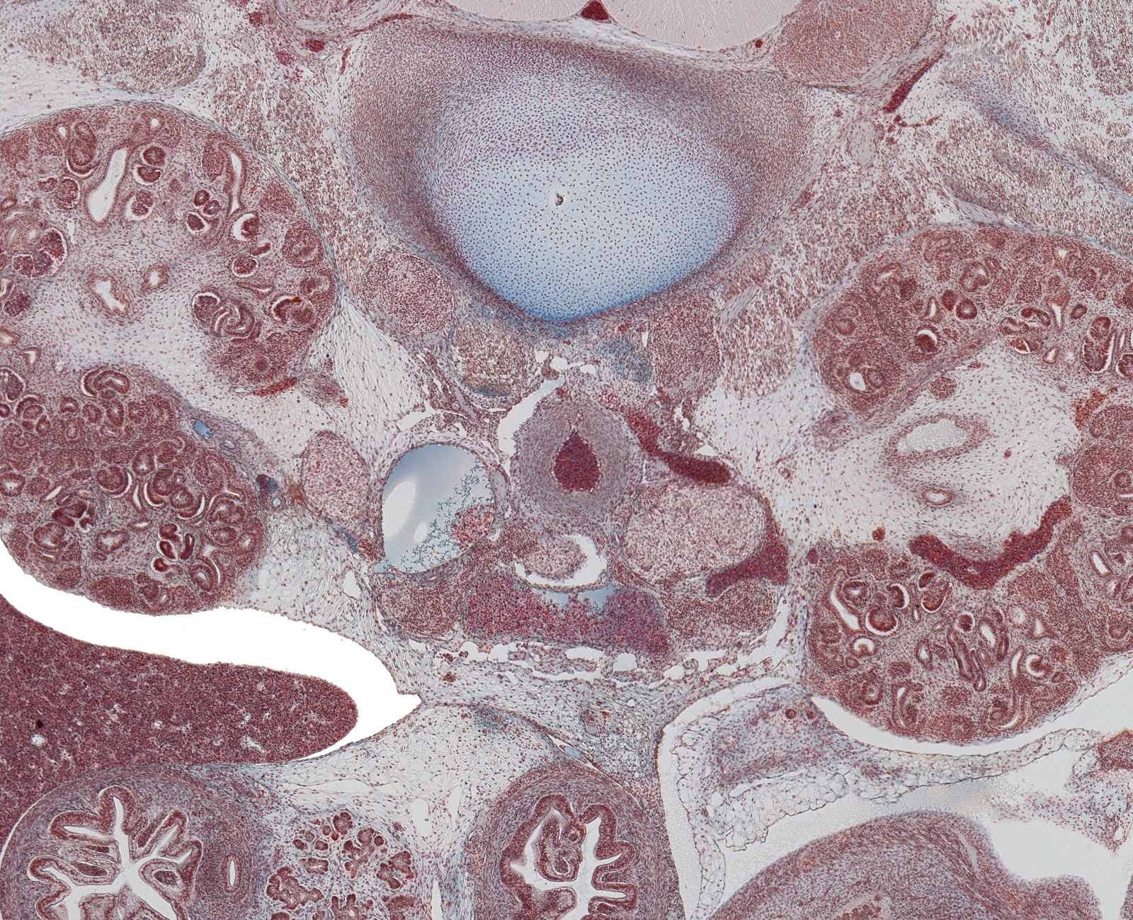 Hilum of Kidneys