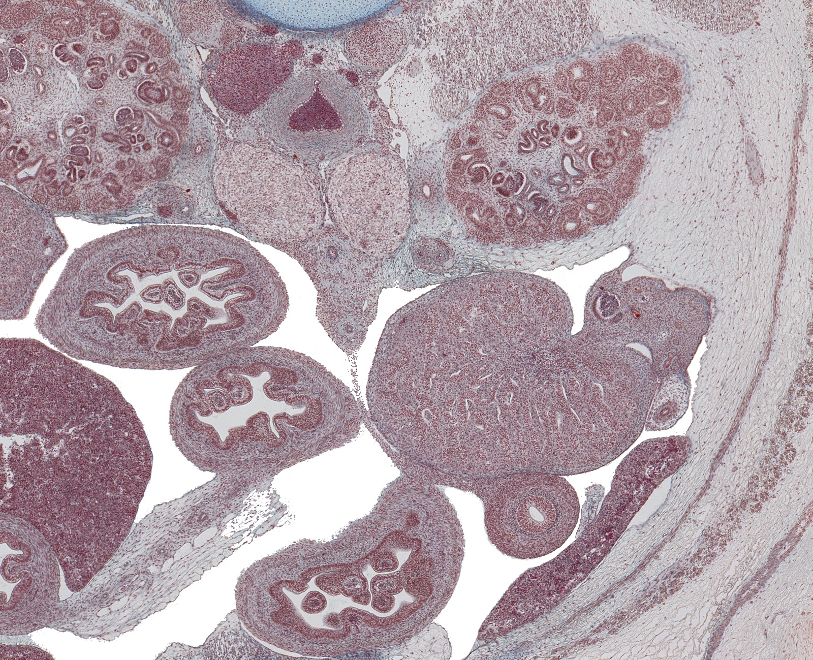 Aortic Bifurcation, Testis, Vas Deferens and Hypogastric Ganglia