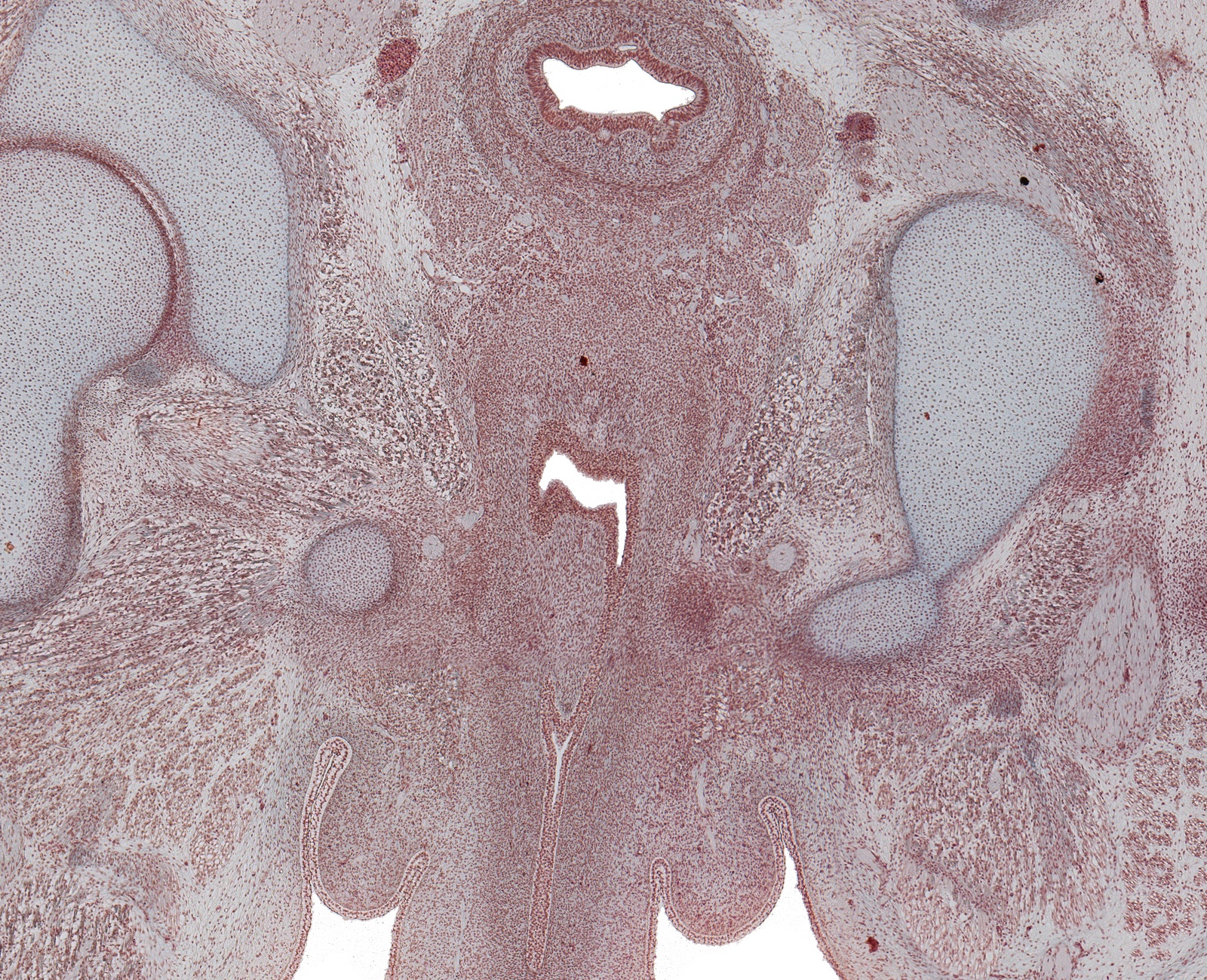 Corpus Spongoisus, Urethra in Penis, Rectum, and Fused Paramesenephric Ducts