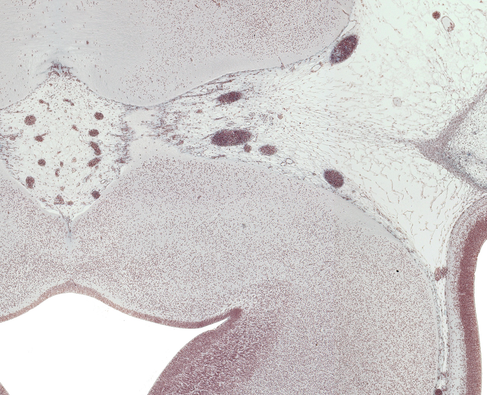 Pyrimidal Tract Basis Pedunculi and CN III Rootlets