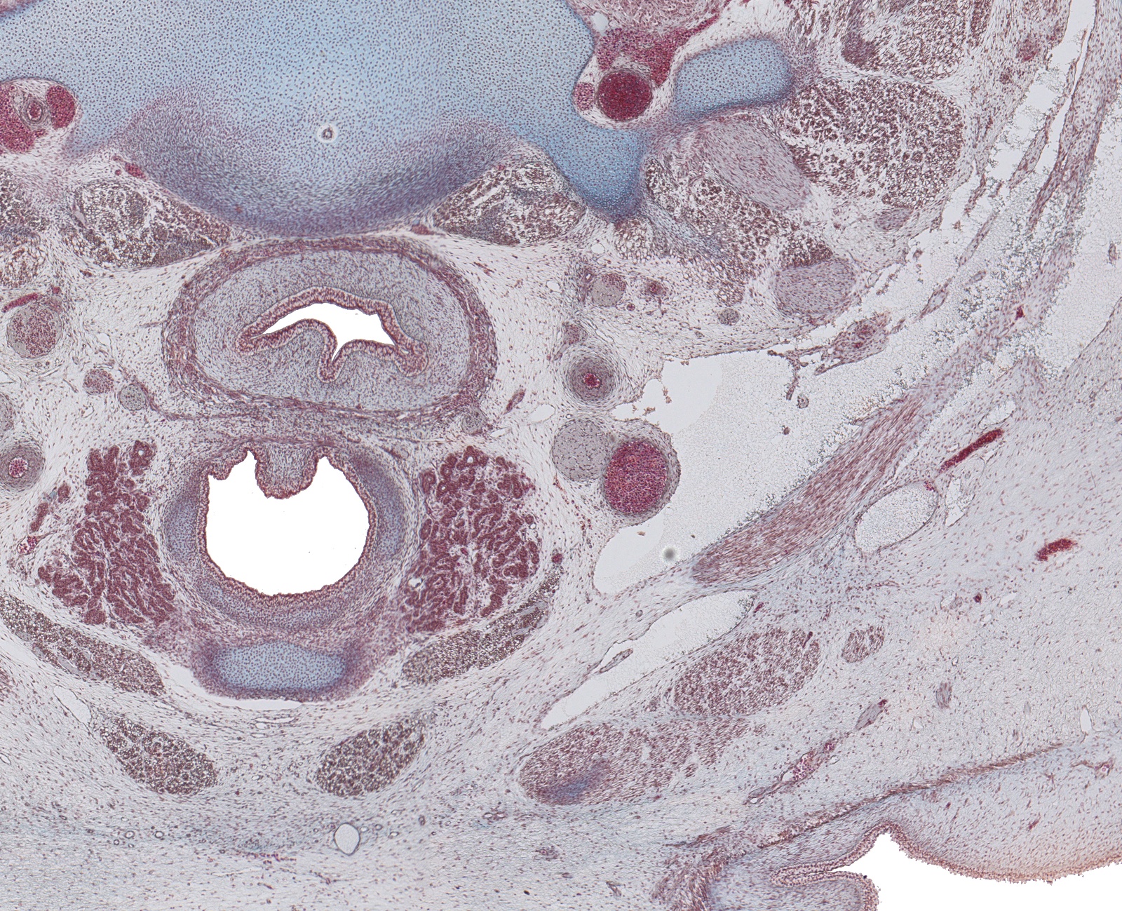 Thyroid Gland and Cartoid Sheath Structures