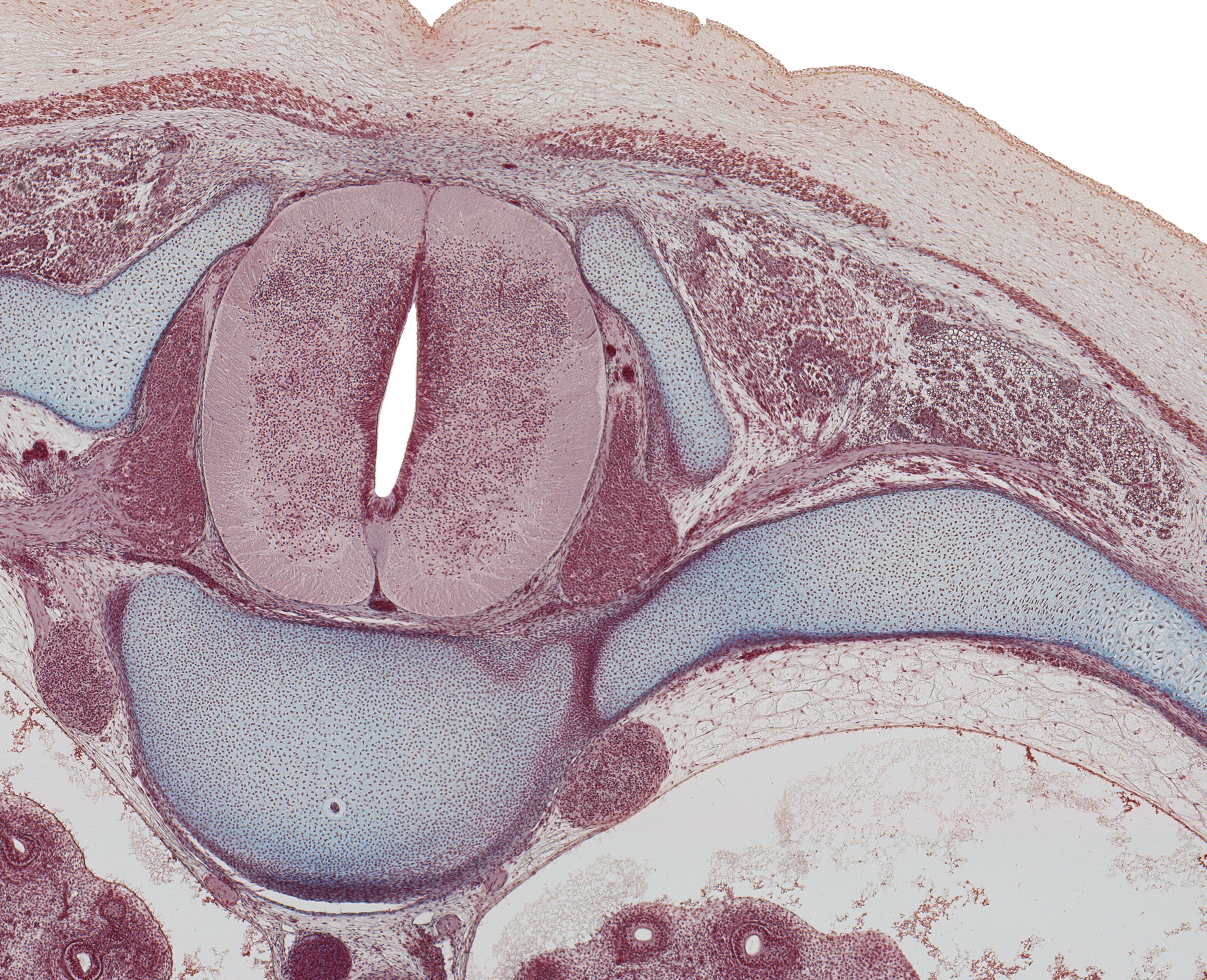 Spinal Cord and Vertebra at T-8