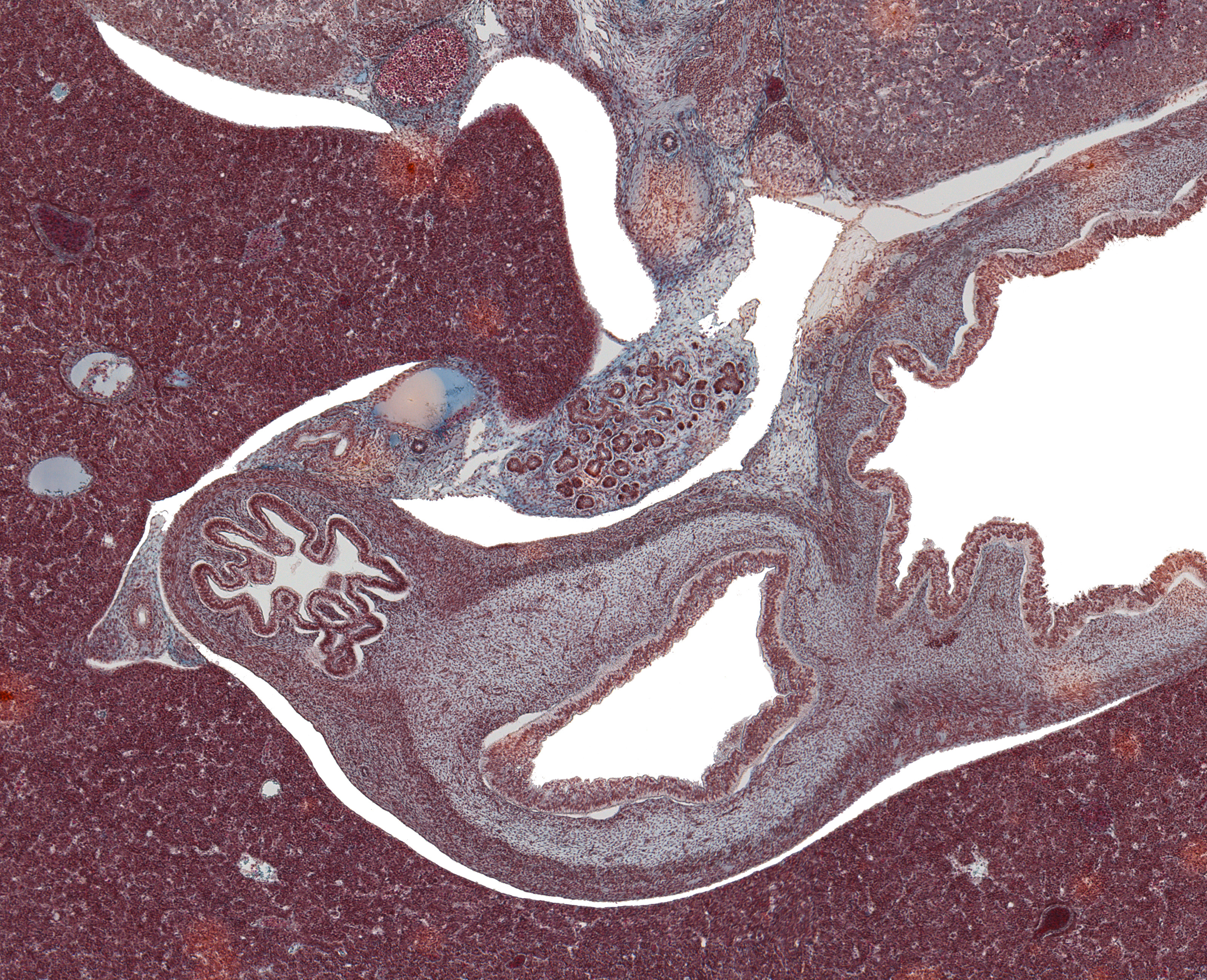 Body of Pancreas and Duodenum