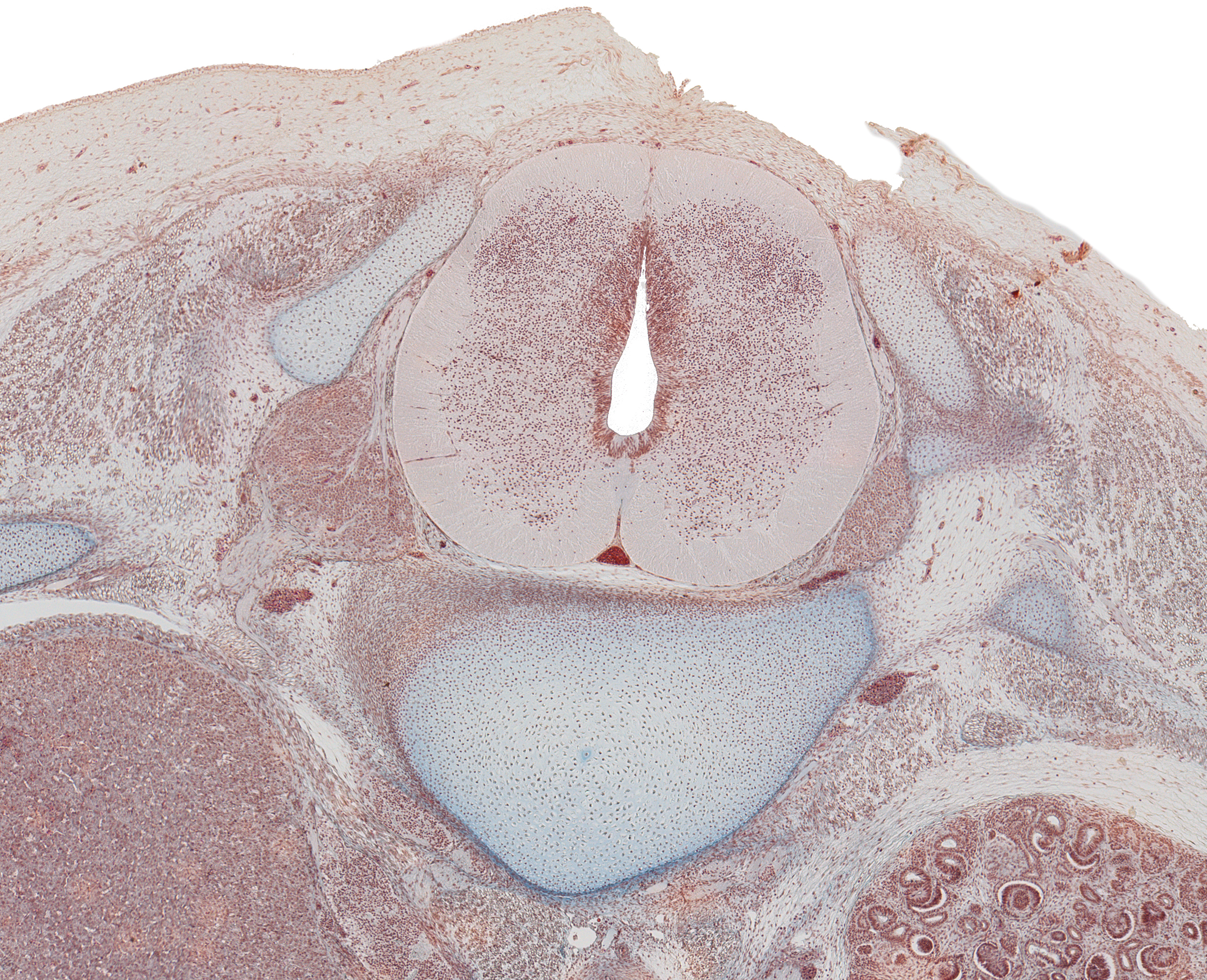 Spinal Cord and Vertebra at T-12