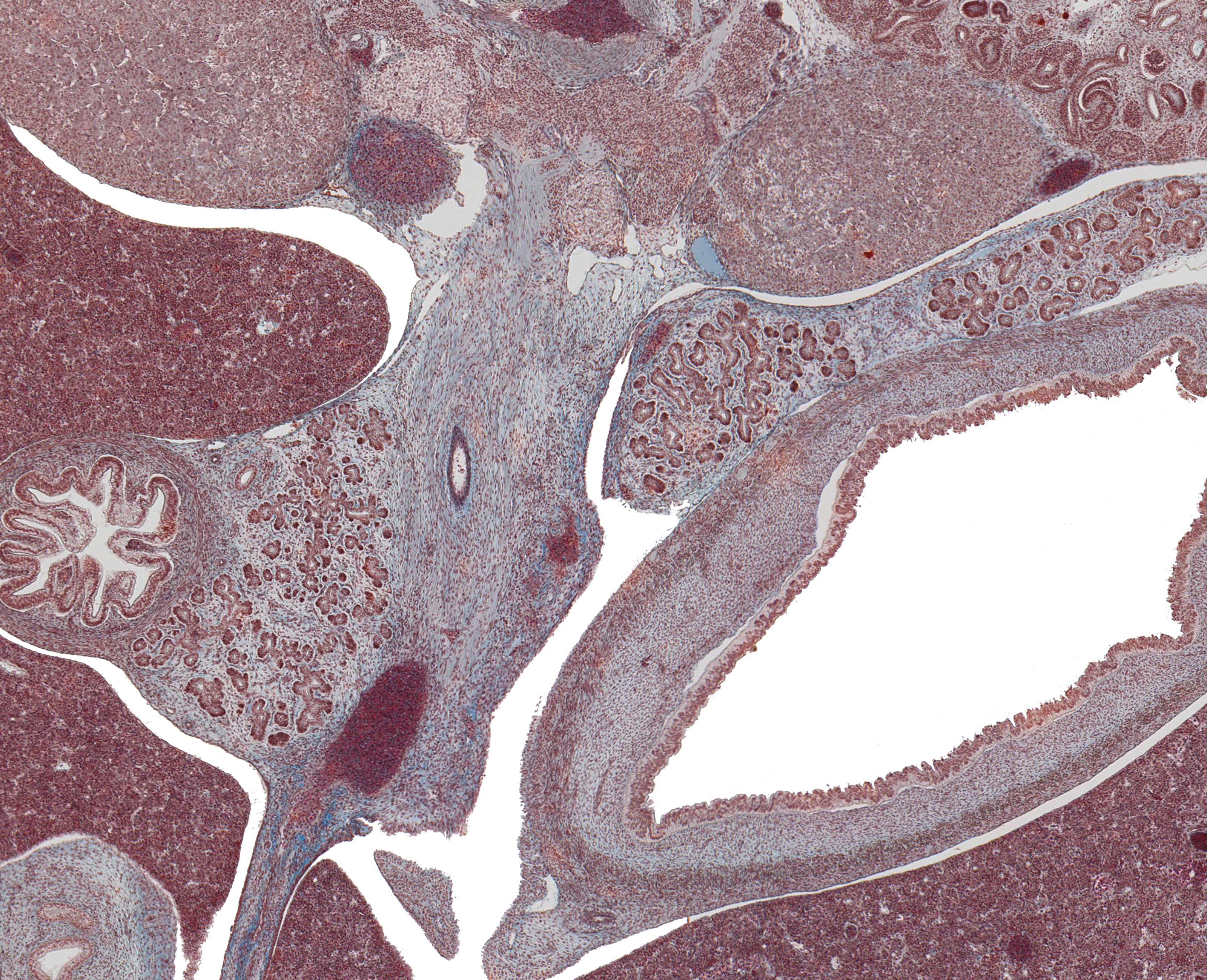 Body of Pancreas, Head of Pancreas, Sup. Mesenteric V, and Lower Supraenal Gland