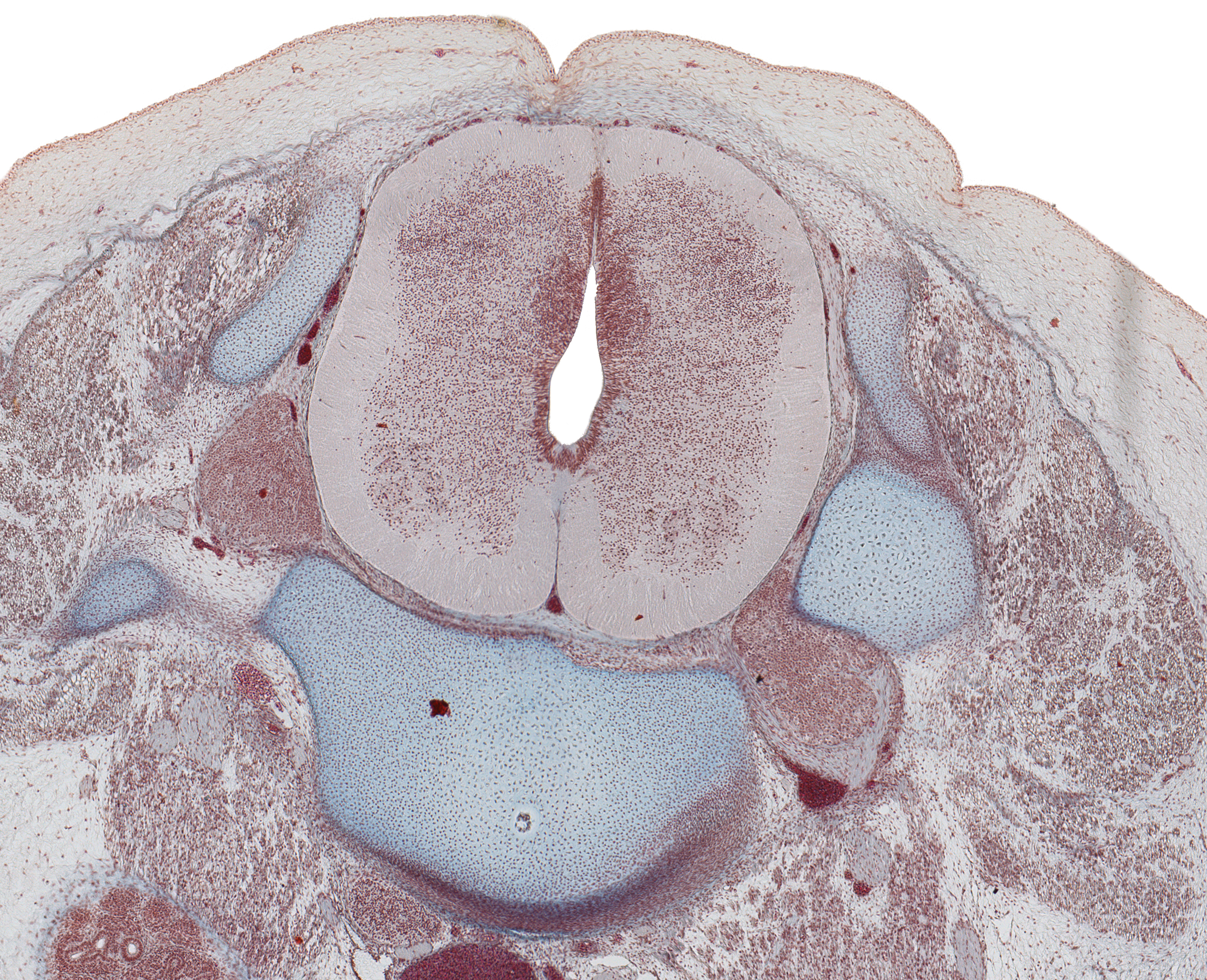 L-3 Spinal Cord and Vertebra