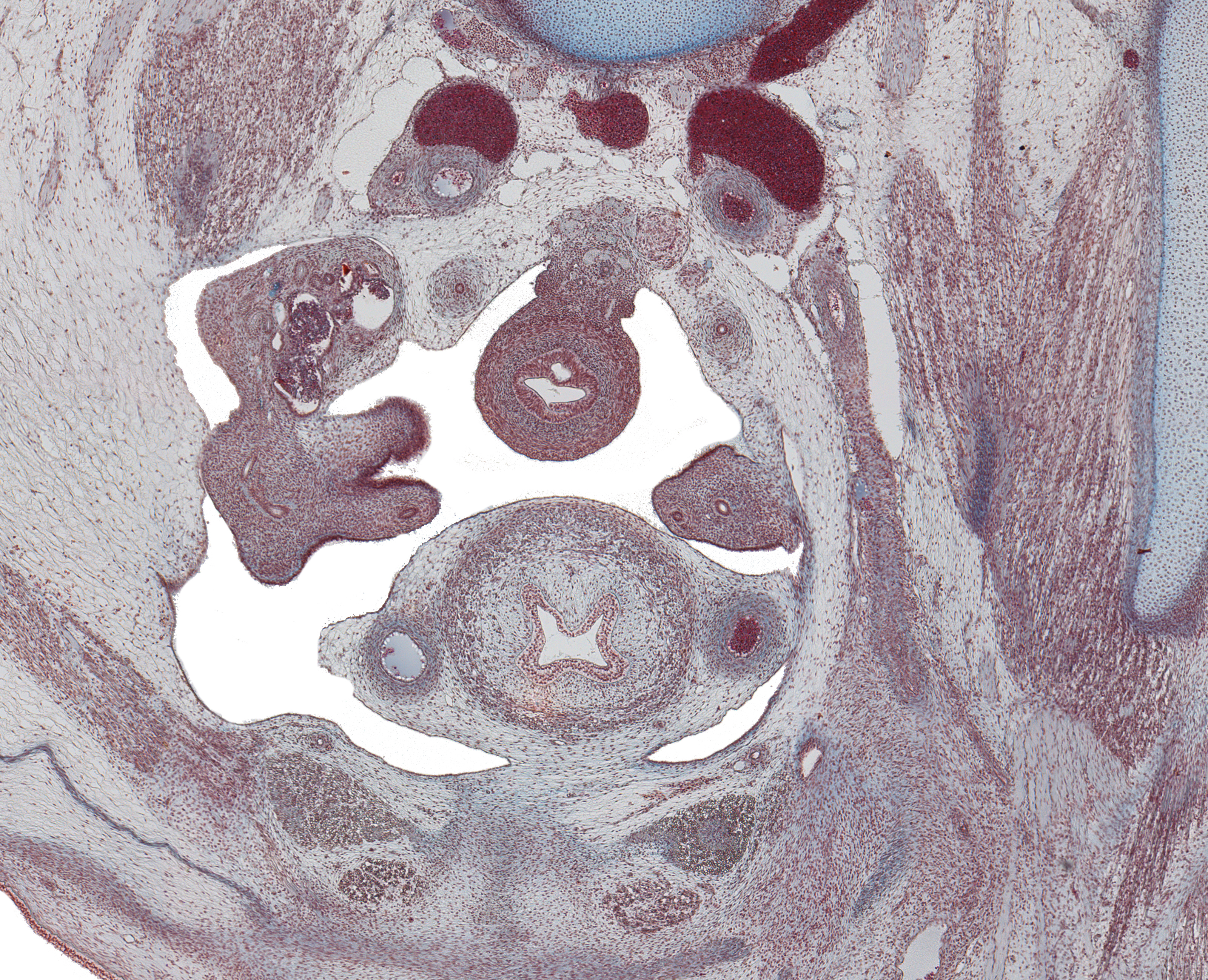 Ureter, Gubernaculum in Inguinal Region and Pubic Symphysis