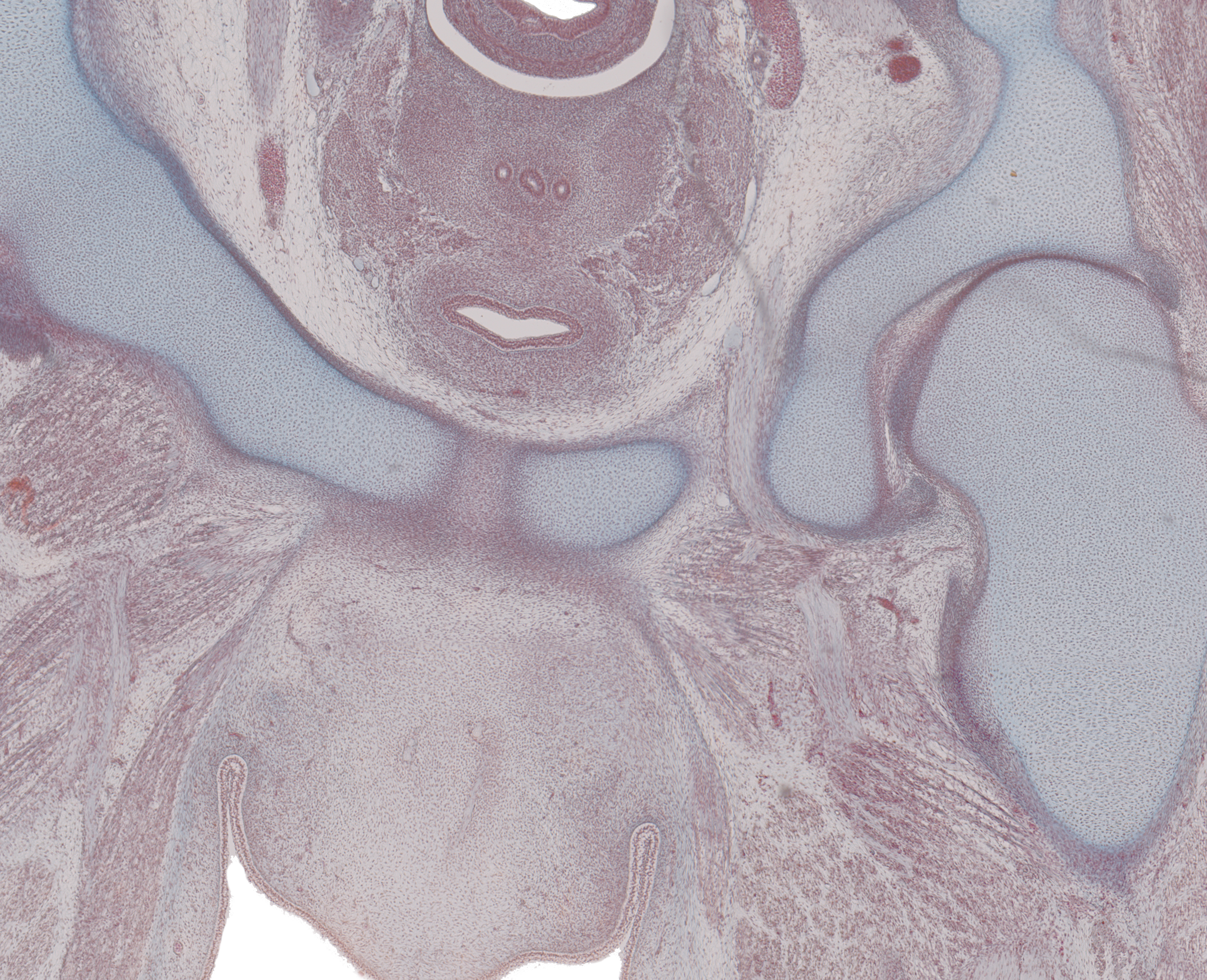 Ureter, Gubernaculum Testis in Scrotal Fold, and Obturator Canal
