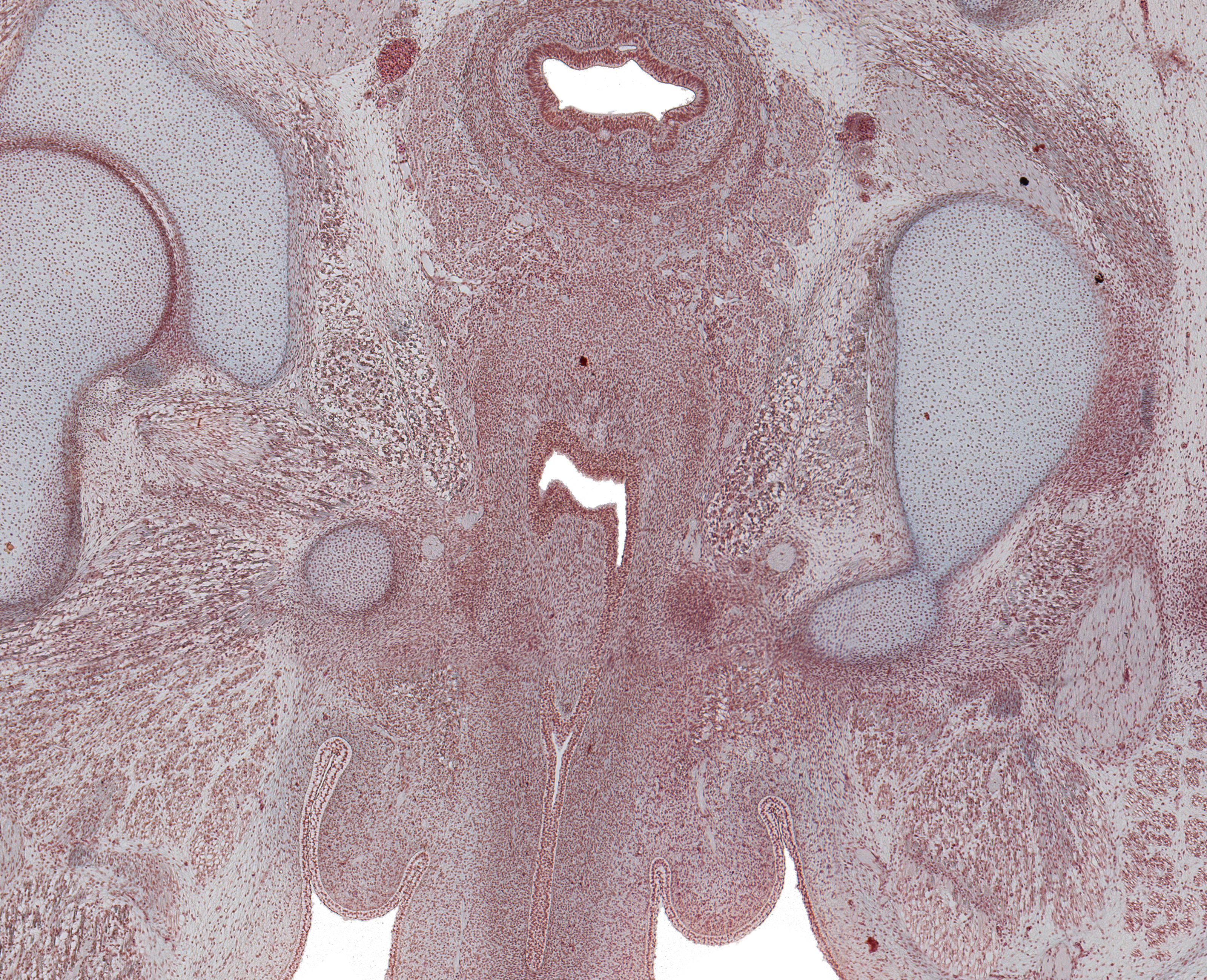 Corpus Spongoisus, Urethra in Penis, Rectum, and Fused Paramesenephric Ducts