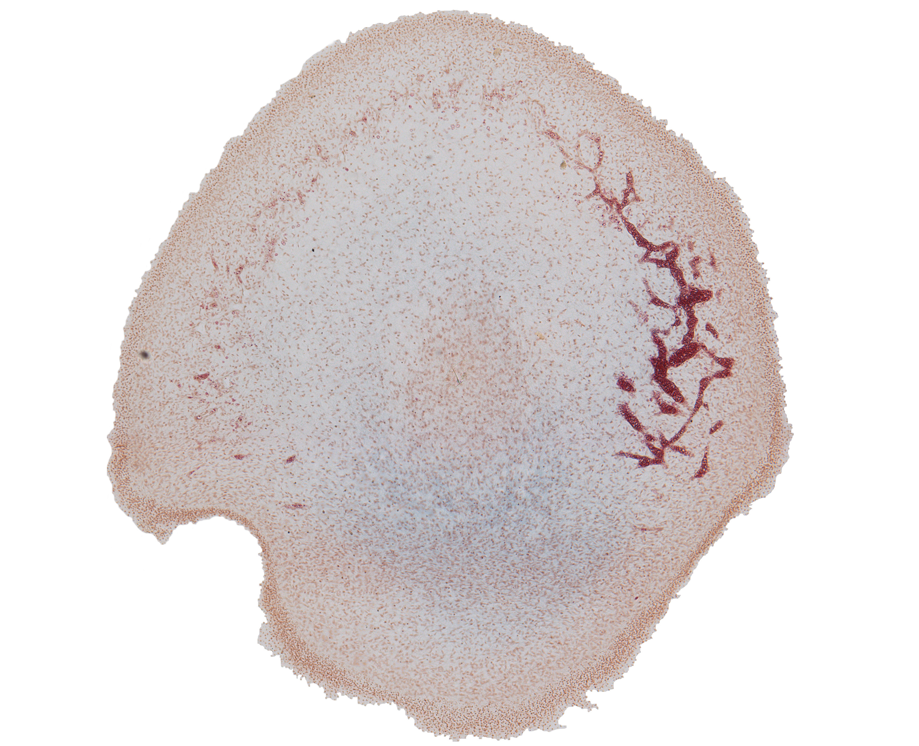 Osteogenic Layer at Top of Head