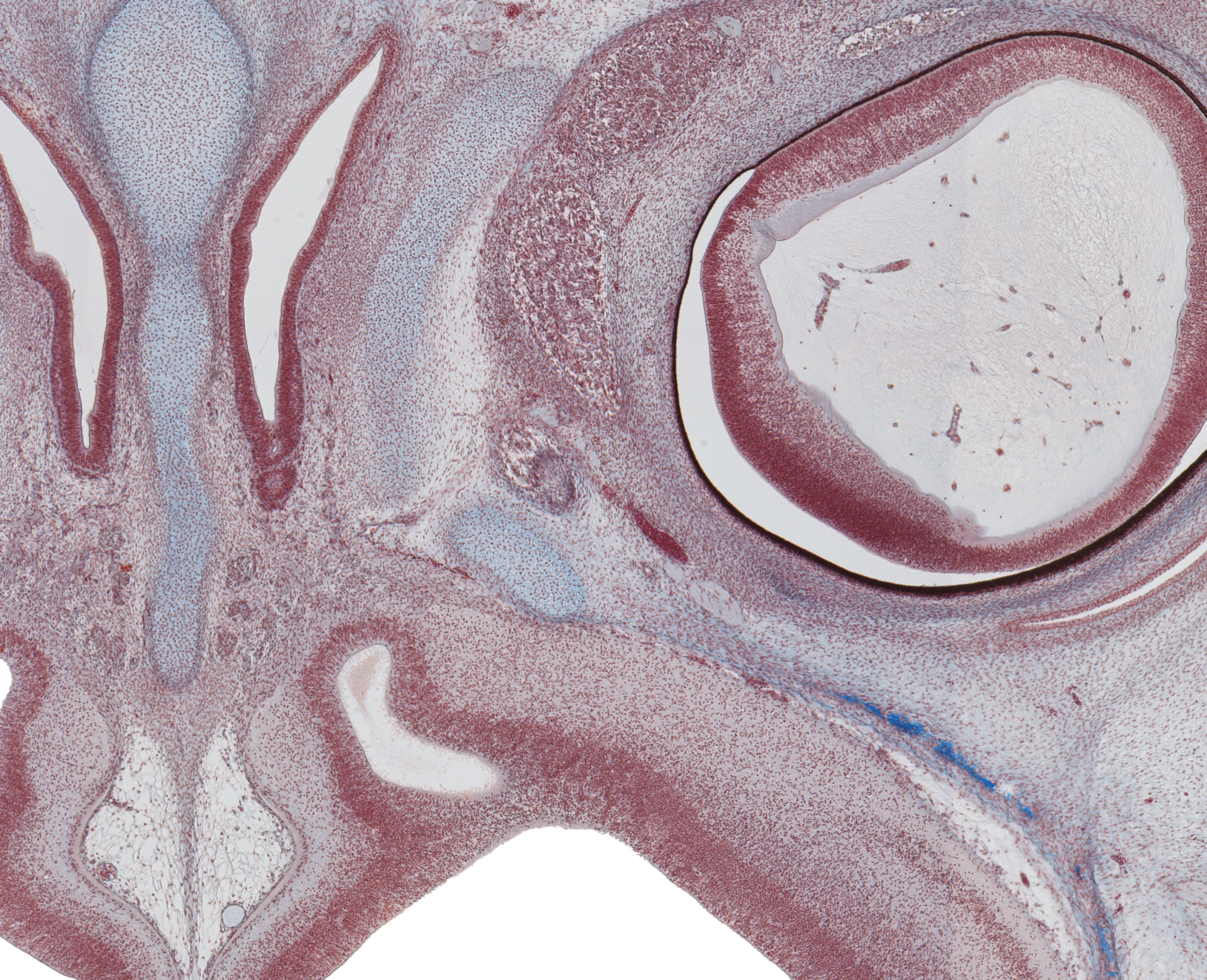 Olfactory Bulb and Frontal Lobe of Cerebral Hemisphere