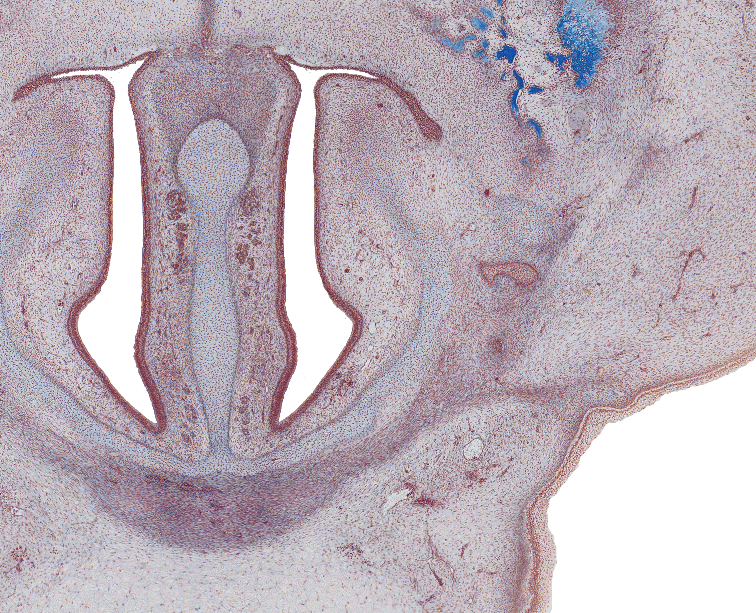 Nasal Cavity and Interorbital Ligament