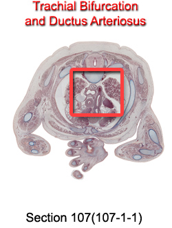 Trachial Bifurcation and Ductus Arteriosus