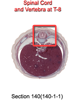 Spinal Cord and Vertebra at T-8