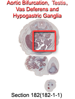 Aortic Bifurcation, Testis, Vas Deferens and Hypogastric Ganglia